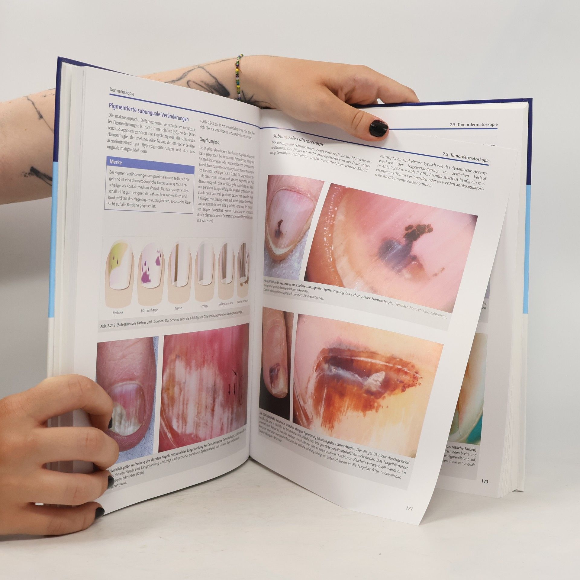 Wilhelm Stolz Bildgebende Diagnostik in der Dermatologie
