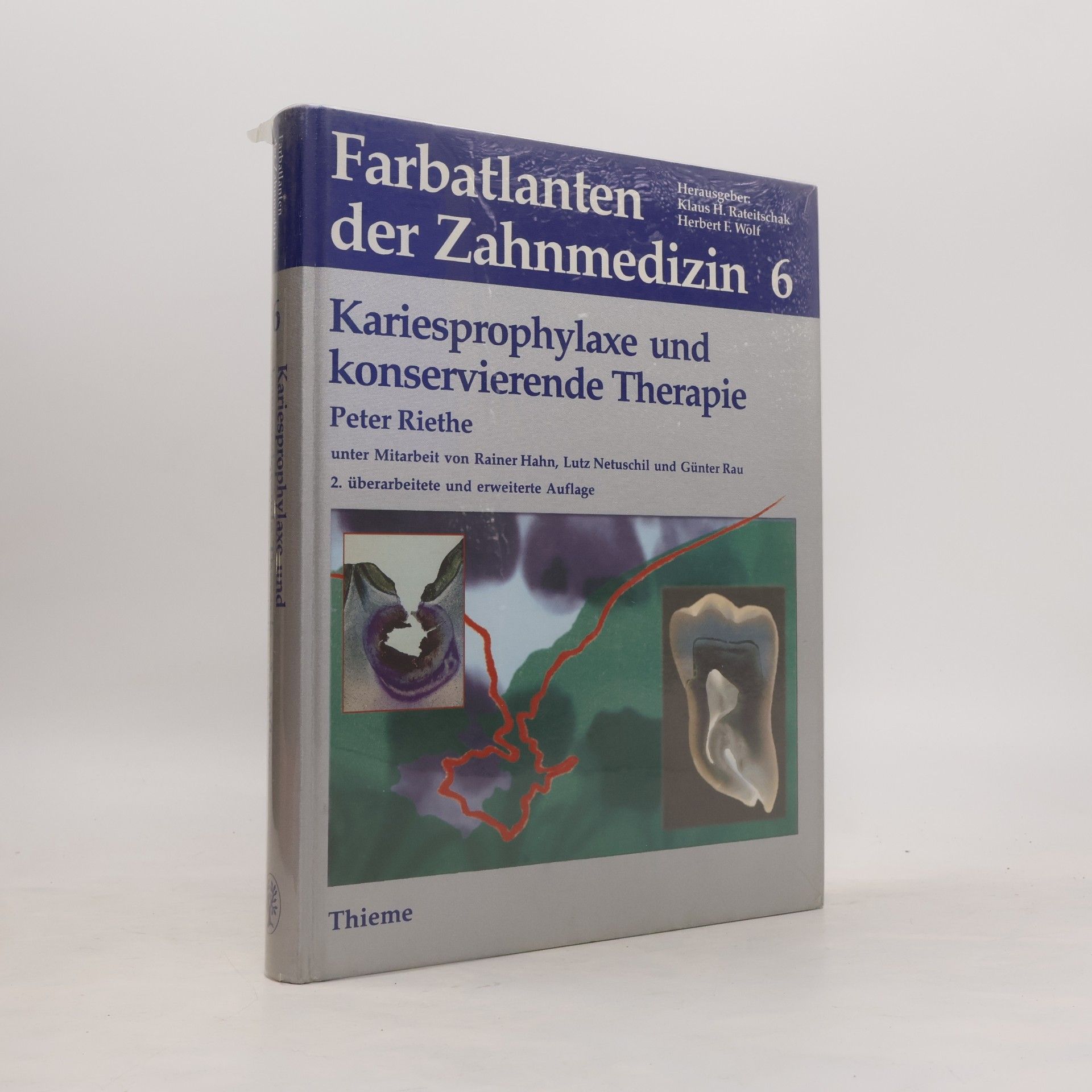 Peter Riethe Kariesprophylaxe und konservierende Therapie