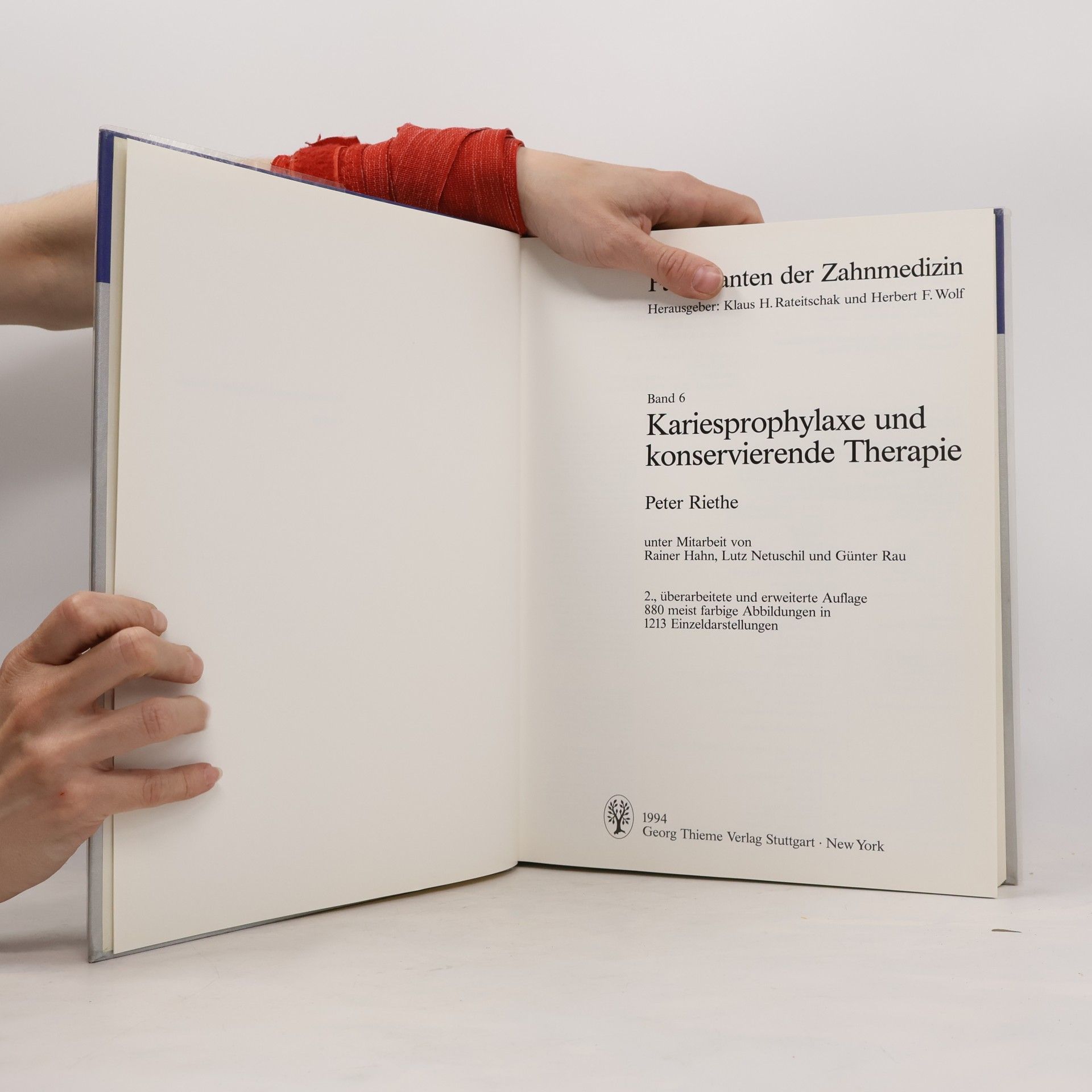 Peter Riethe Kariesprophylaxe und konservierende Therapie