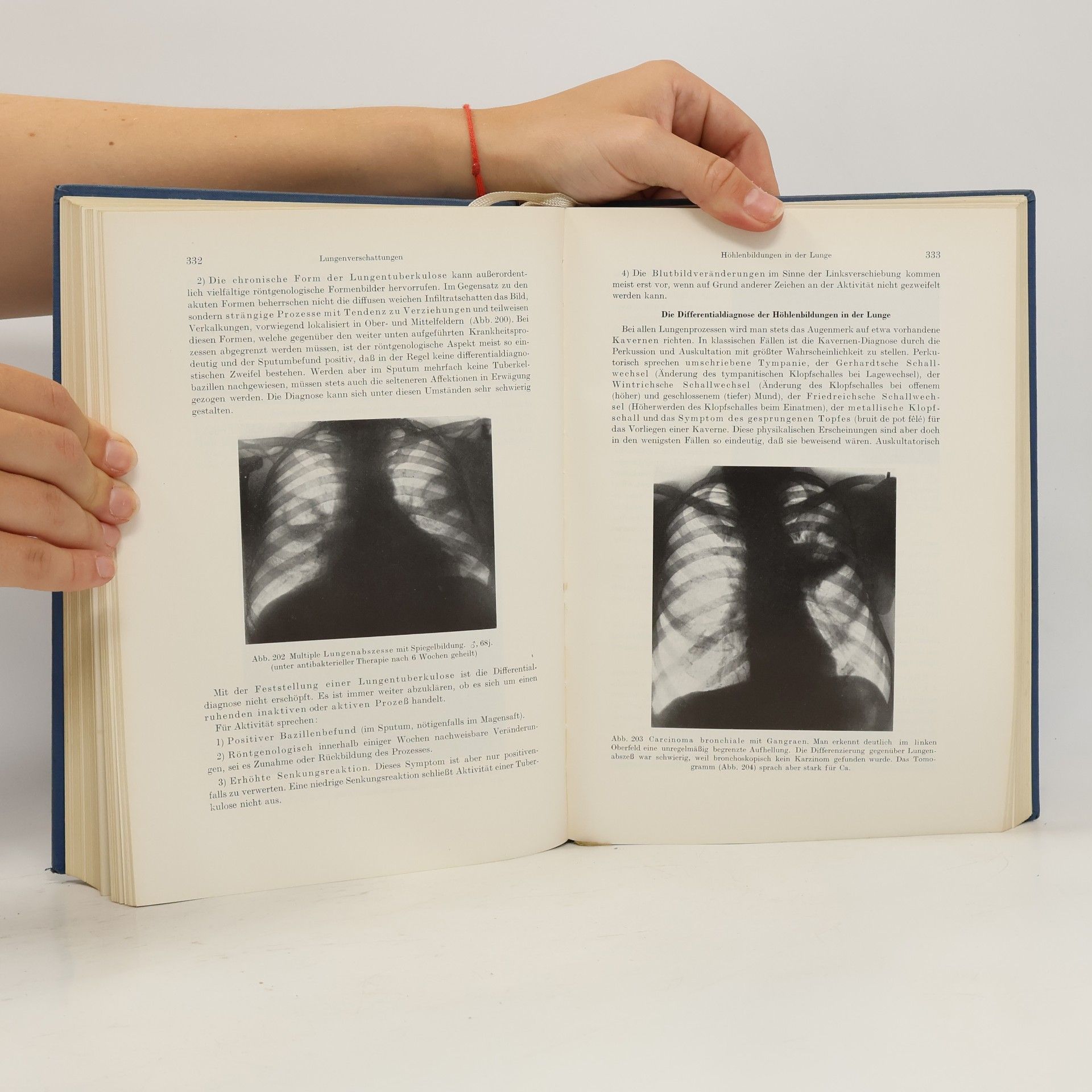 Robert Hegglin Differenzialdiagnose Innerer Krankheiten