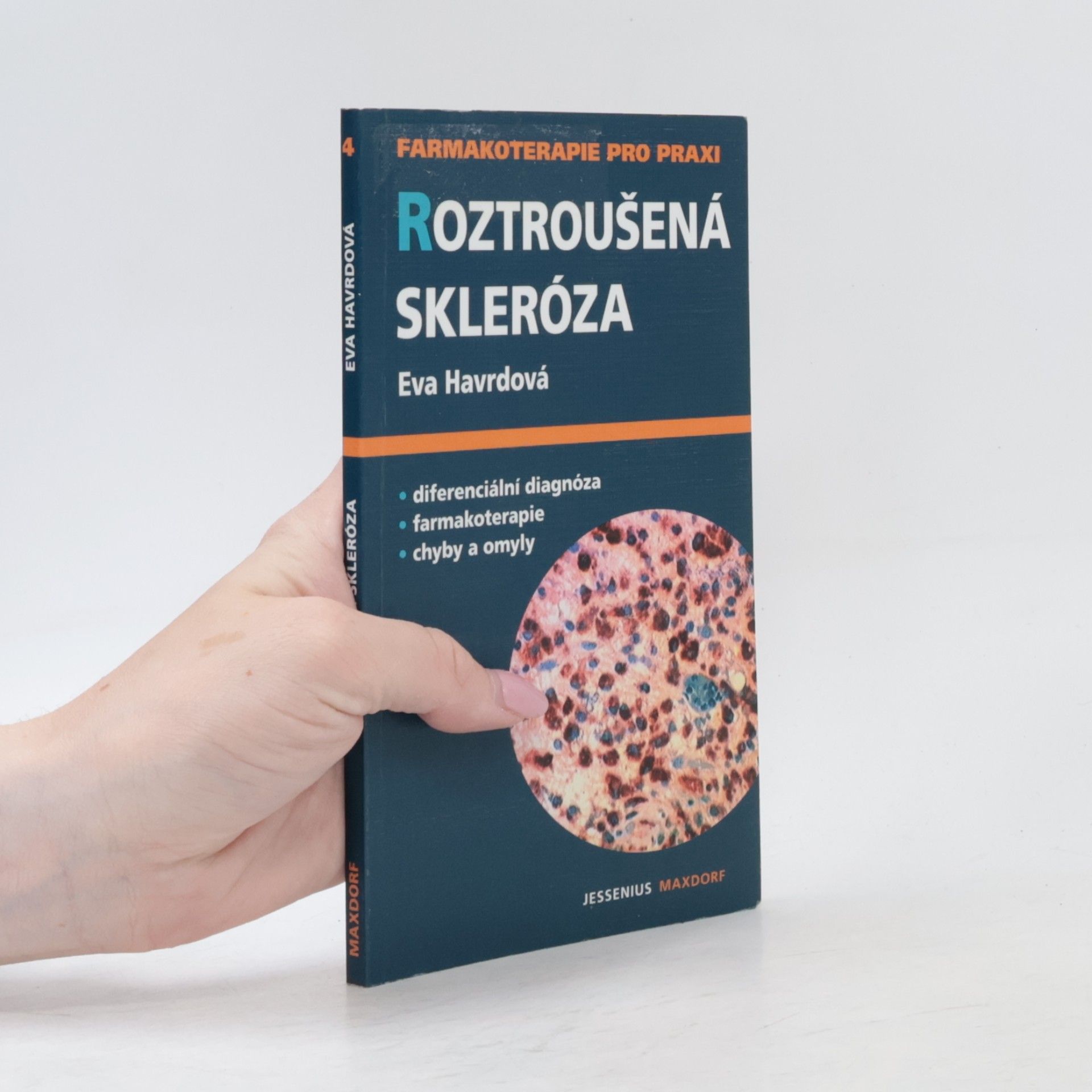 Eva Havrdová Roztroušená skleróza : průvodce ošetřujícího lékaře