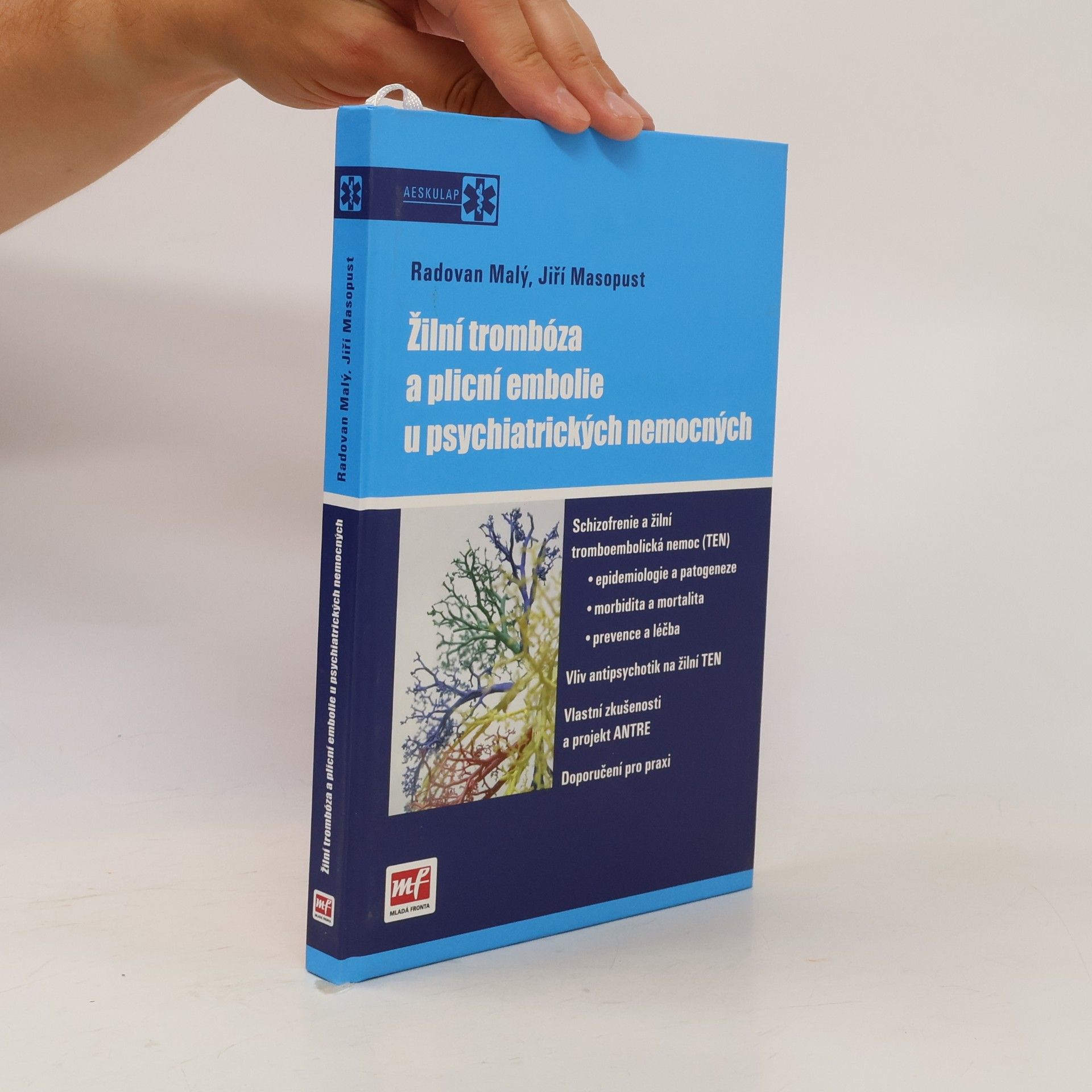 Žilní trombóza a plicní embolie u psychiatrických nemocných