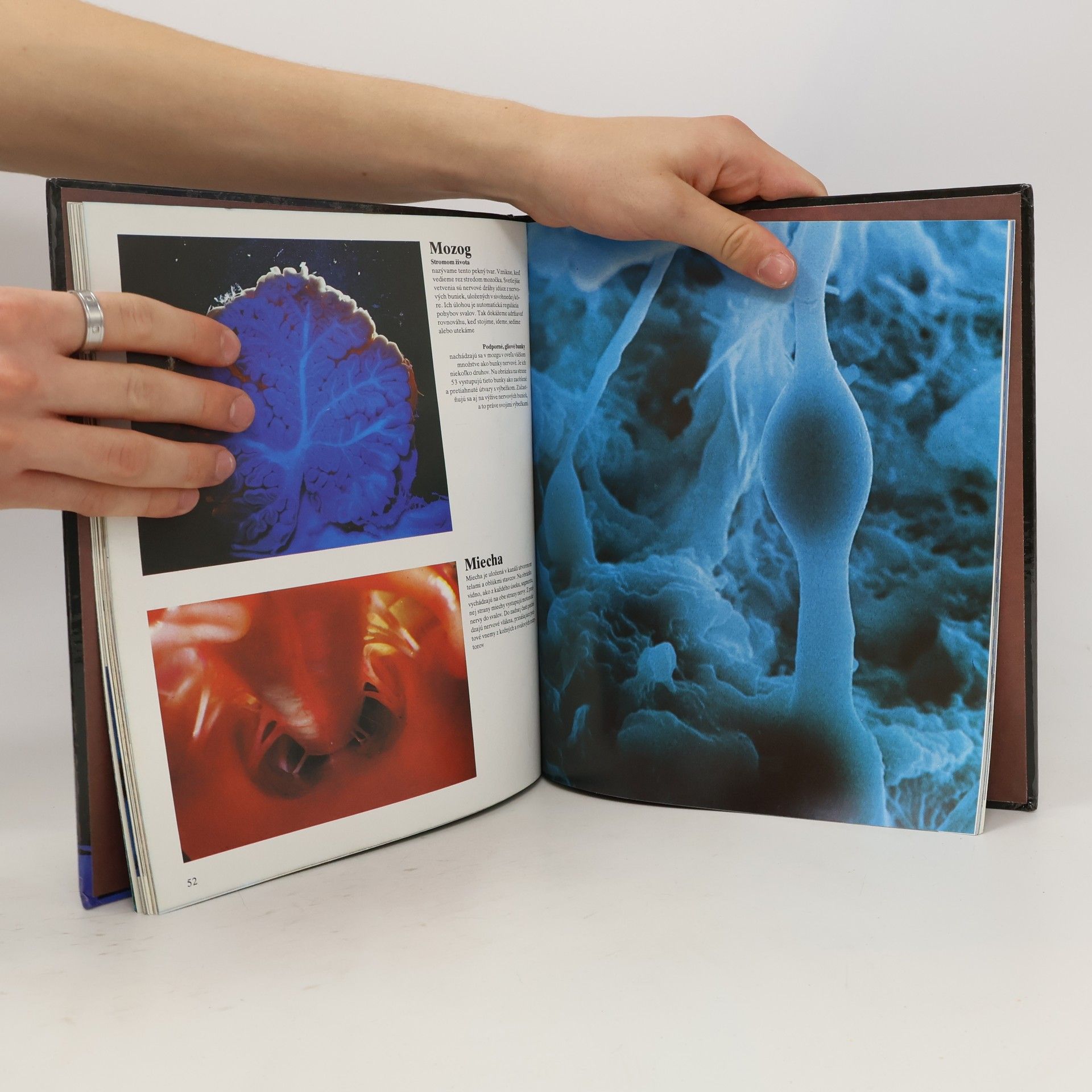 Various authors Ako sa nepoznáme: Objavná cesta s fotografickým aparátom do nášho tela