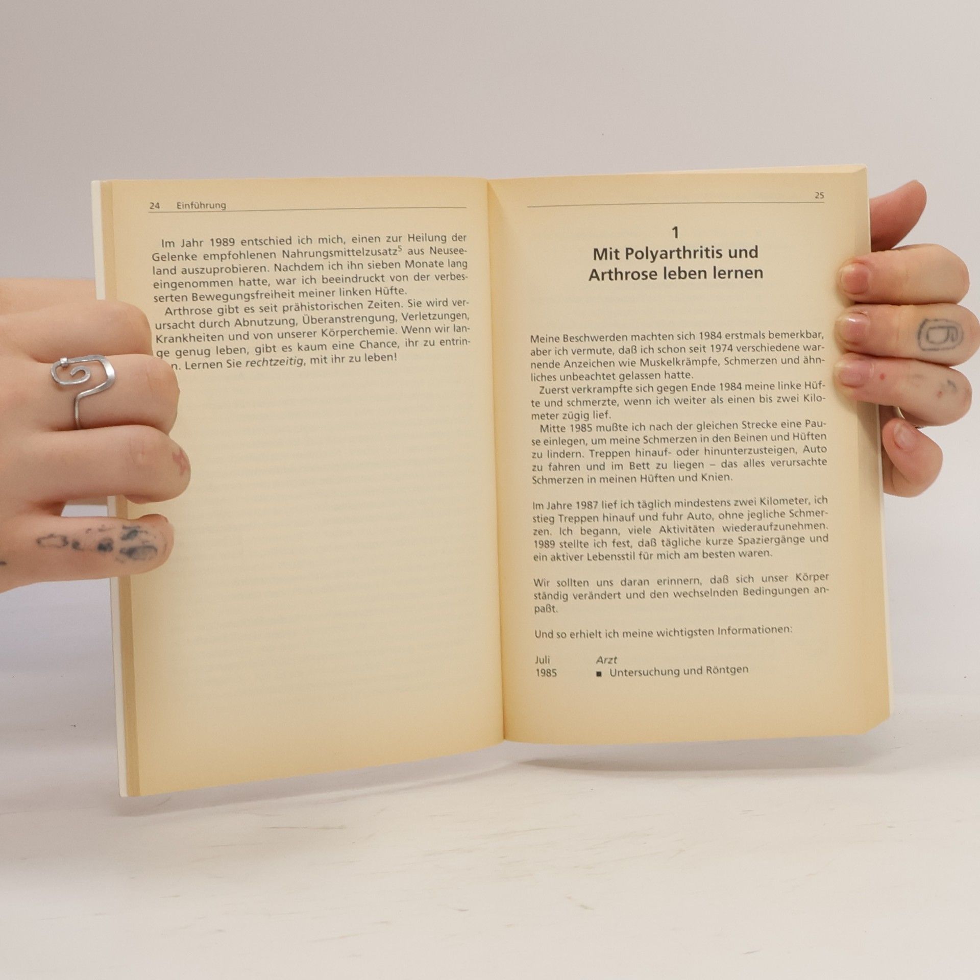 Fred L. Savage Mit Polyarthritis und Arthrose leben