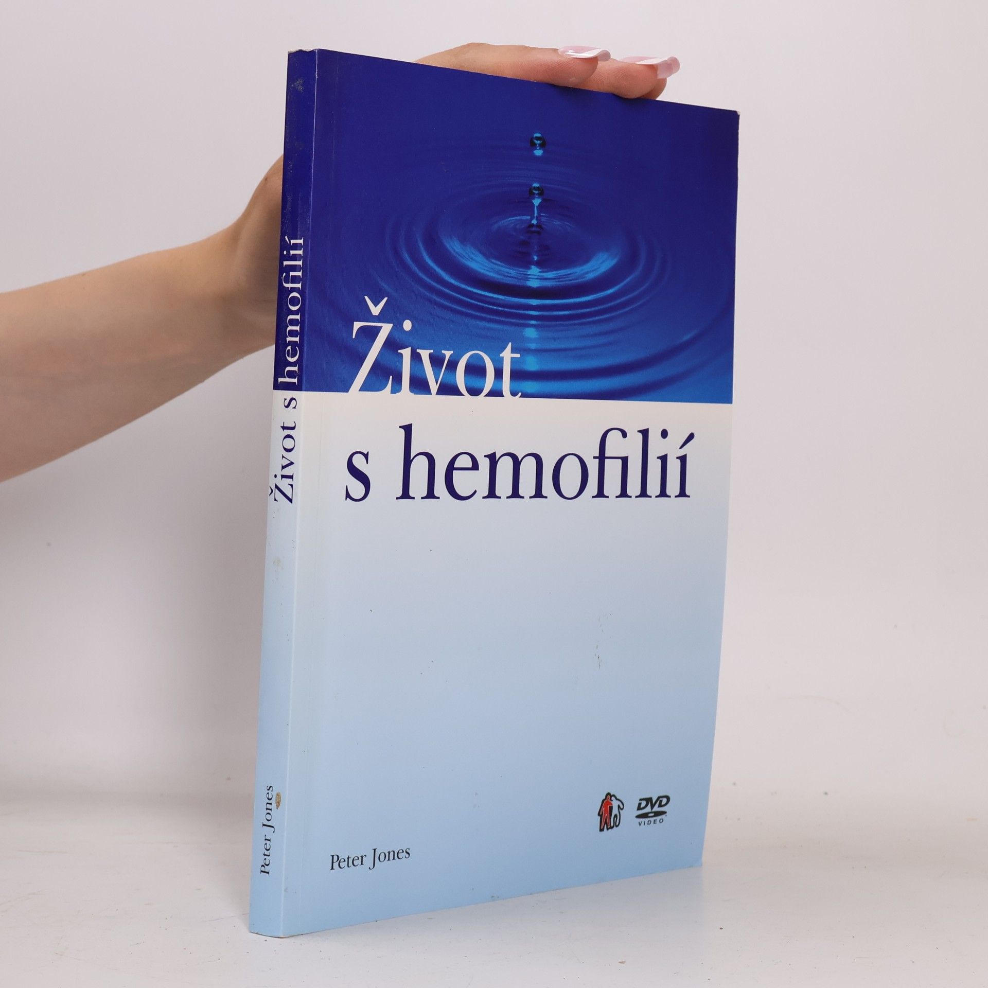 Peter V. Jones Život s hemofilií