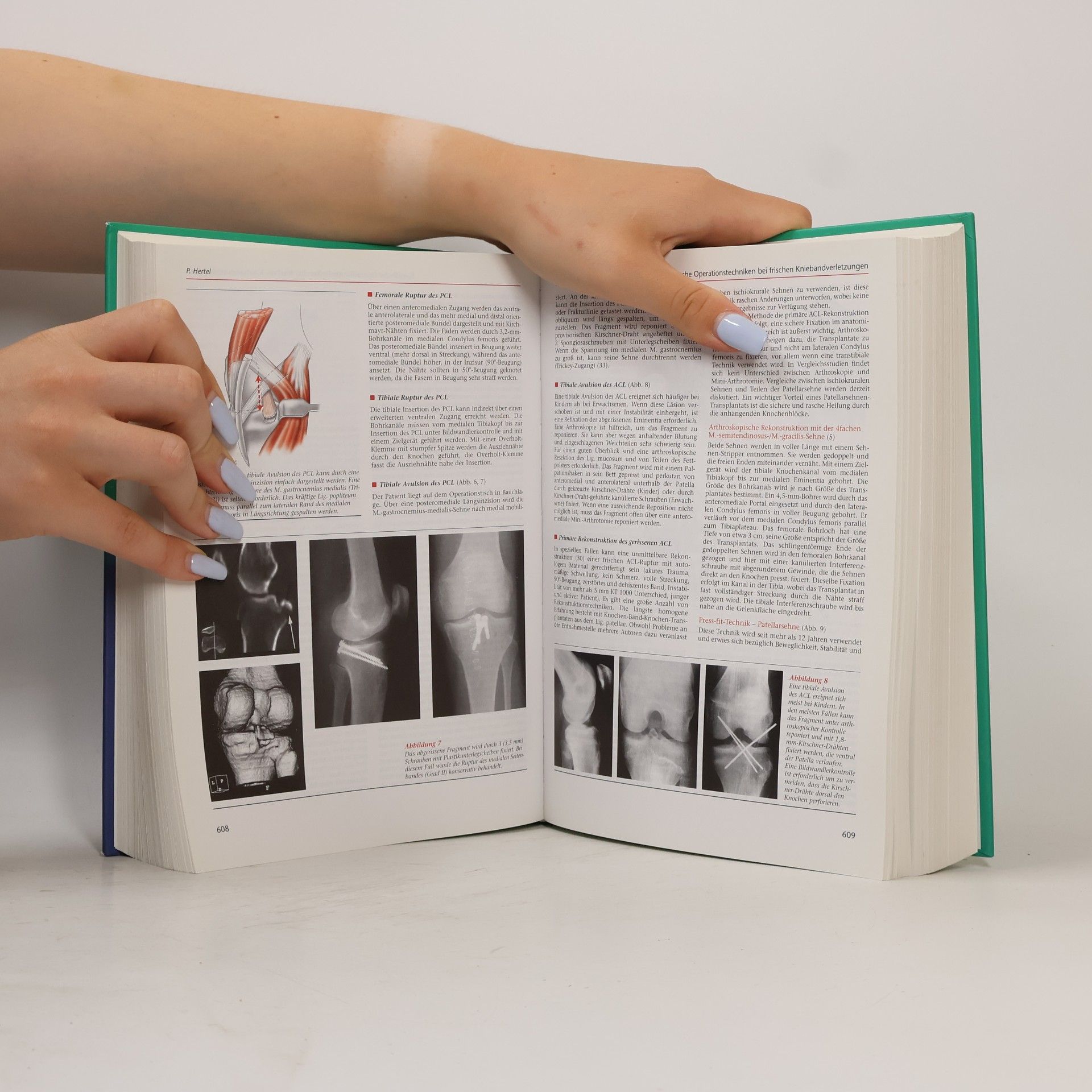 Jacques Duparc Chirurgische Techniken in Orthopädie und Traumatologie