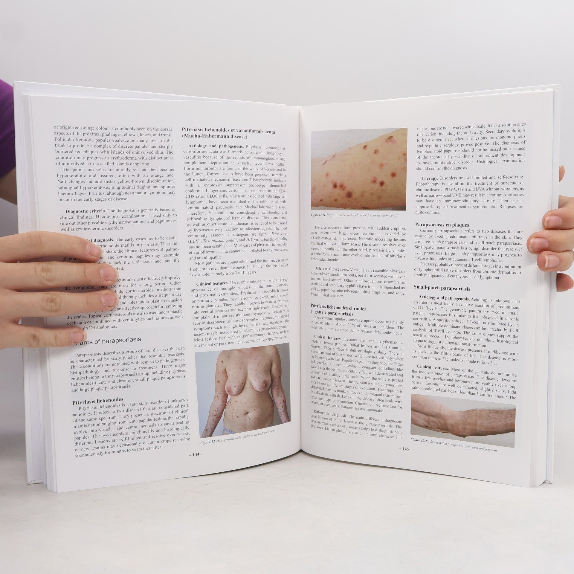 Danka Švecová Textbook of Dermatology