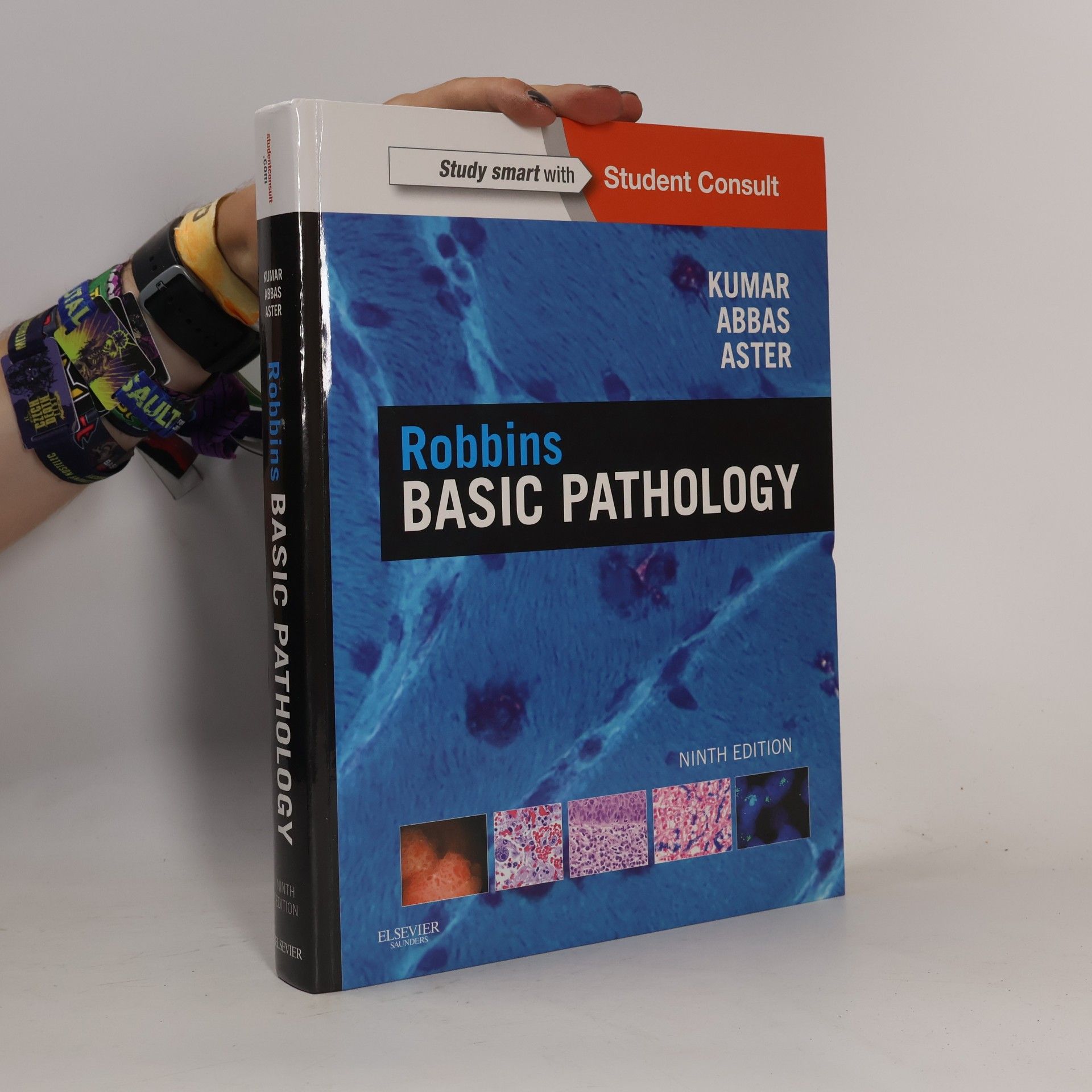 Viay Kumar Robbins basic pathology