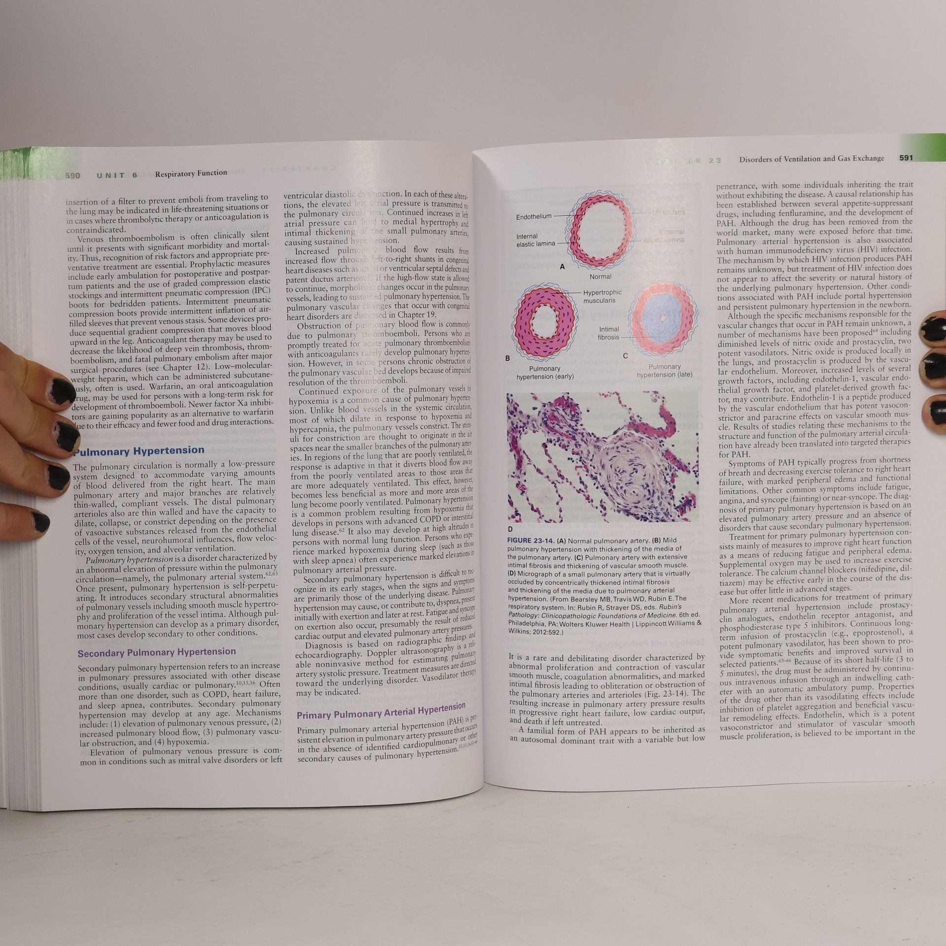 AA.VV. Essentials of Pathophysiology