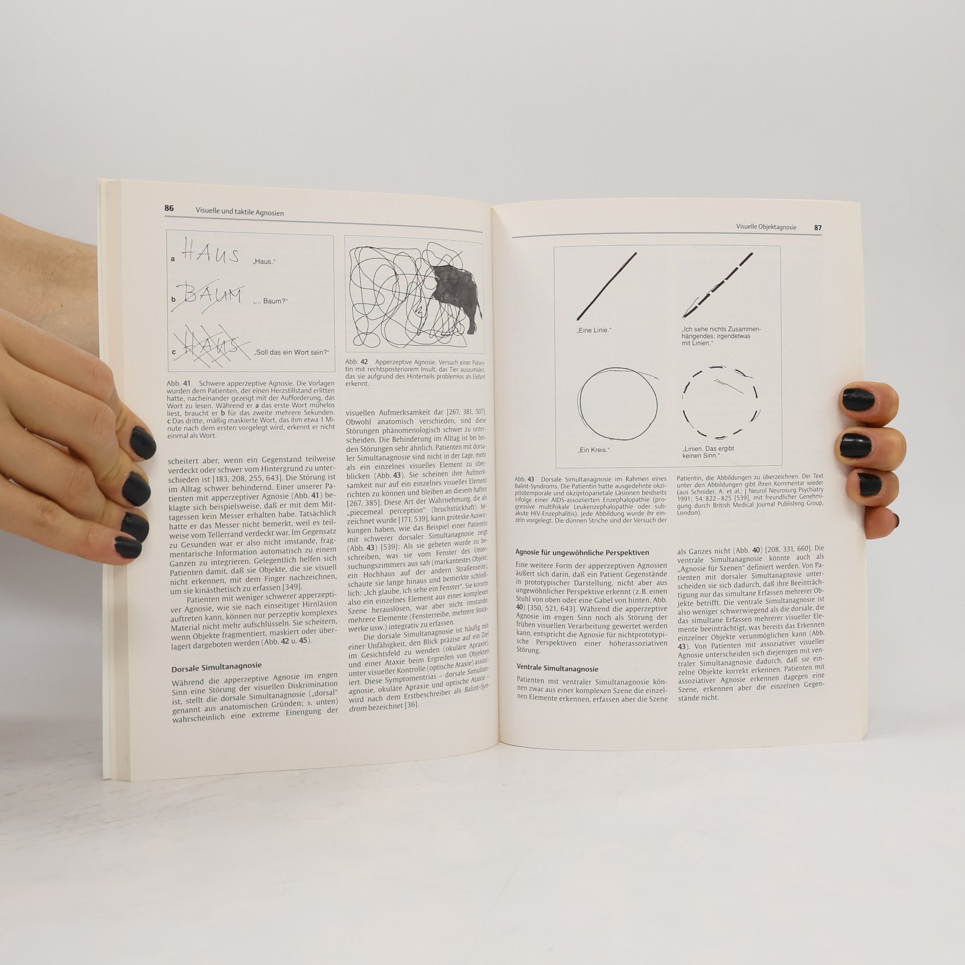 Armin Schnider Verhaltensneurologie