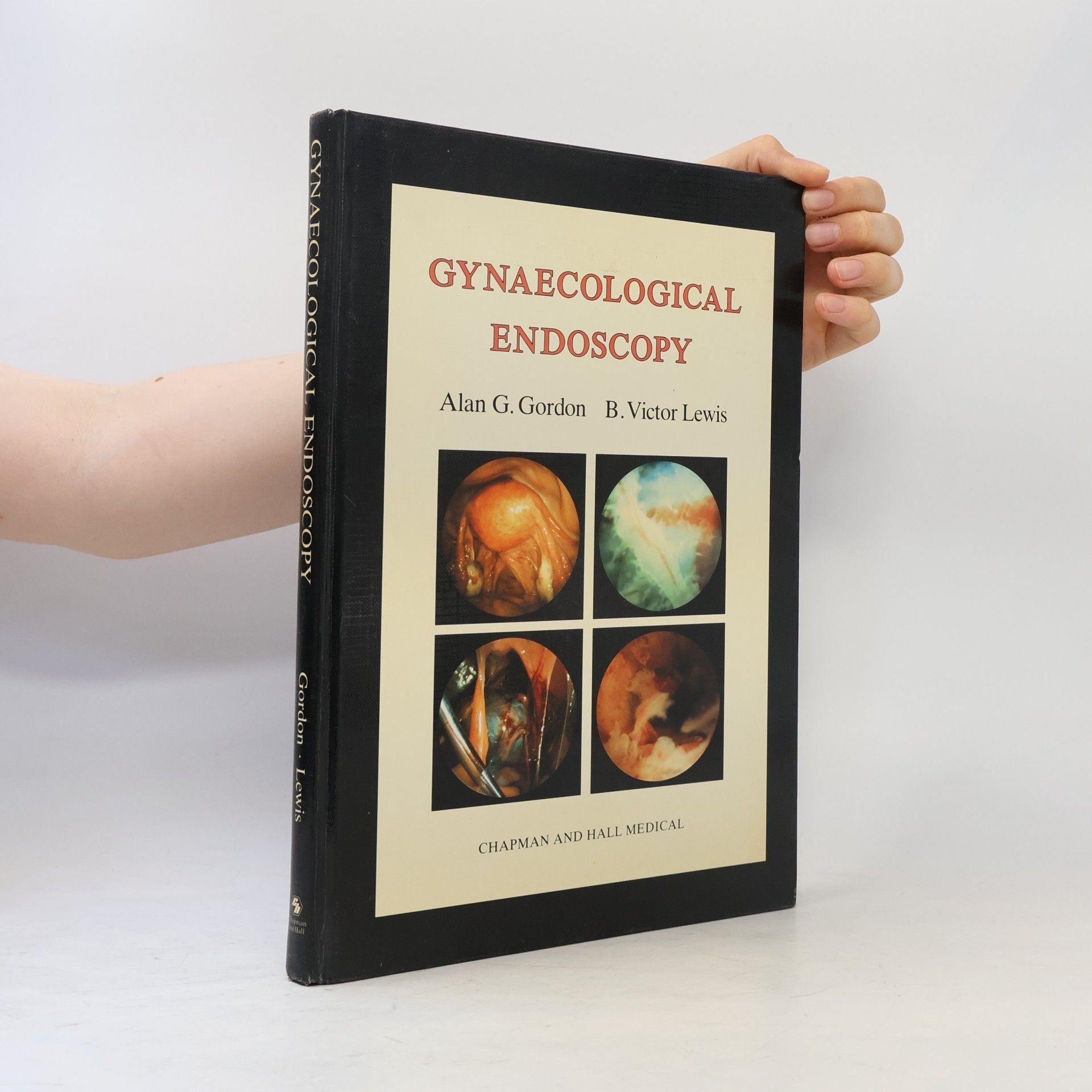 Alan G. Gordon Gynaecological Endoscopy