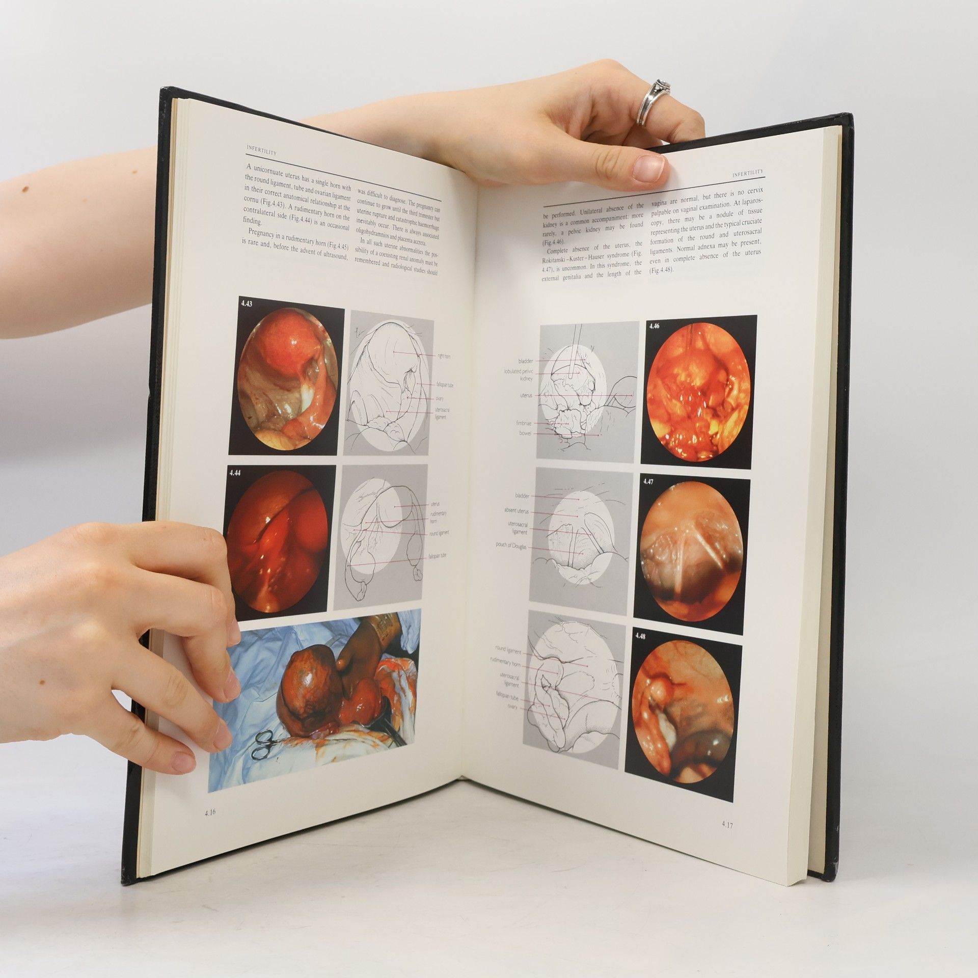 Alan G. Gordon Gynaecological Endoscopy
