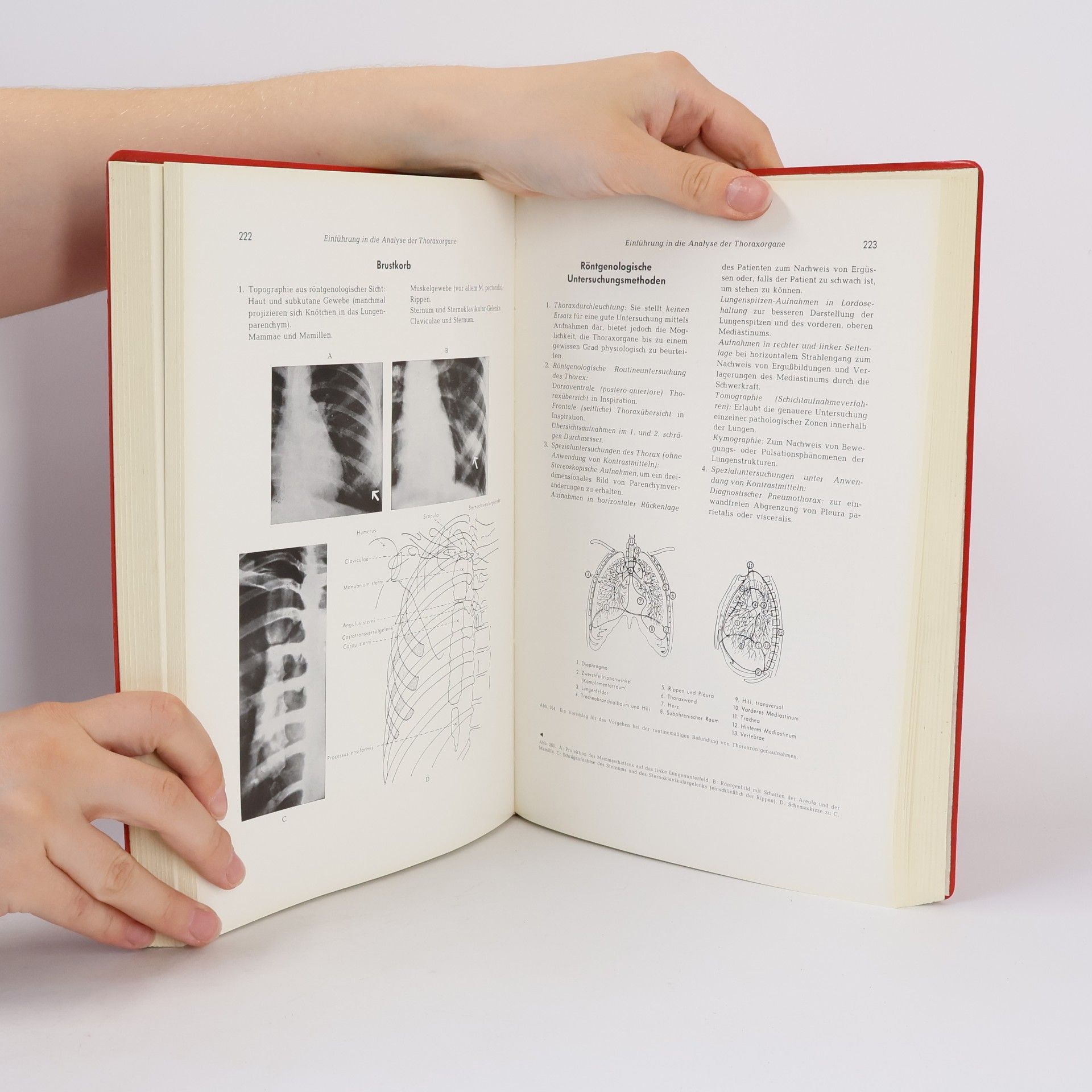 Autorenkollektiv Synopsis der Röntgendiagnostik