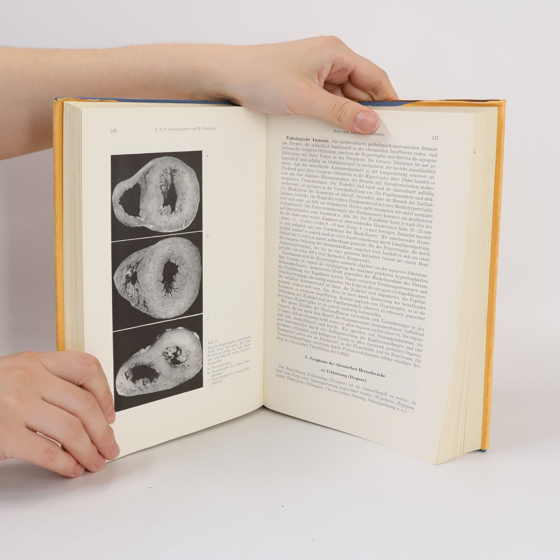 August Sundermann Lehrbuch der inneren Medizin, Band II.