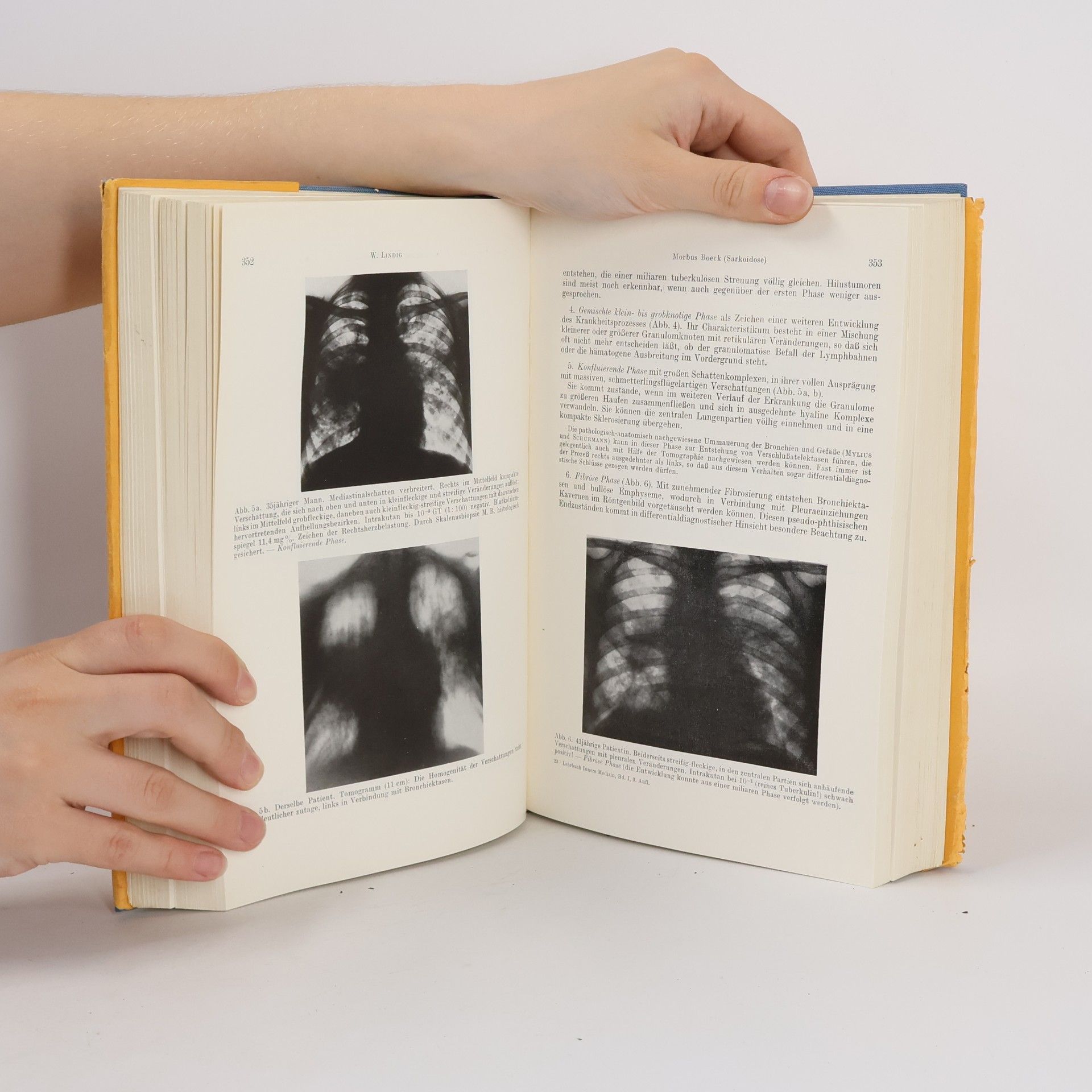 August Sundermann Lehrbuch der inneren Medizin, Band I.