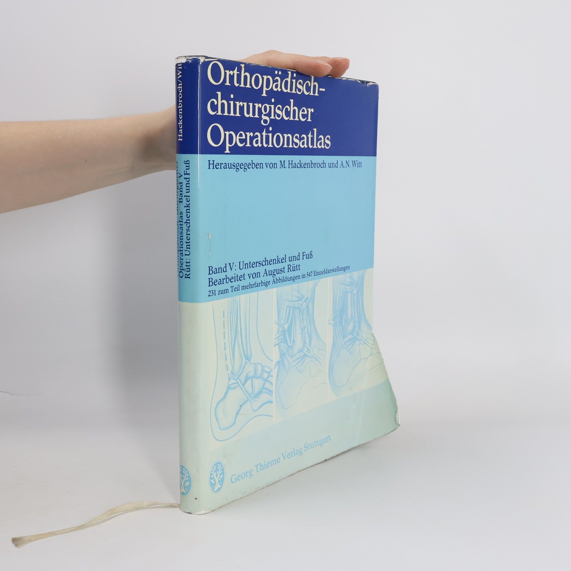 Orthopädisch-chirurgischer Operationsatlas, Band V, Unterschenkel und Fuß