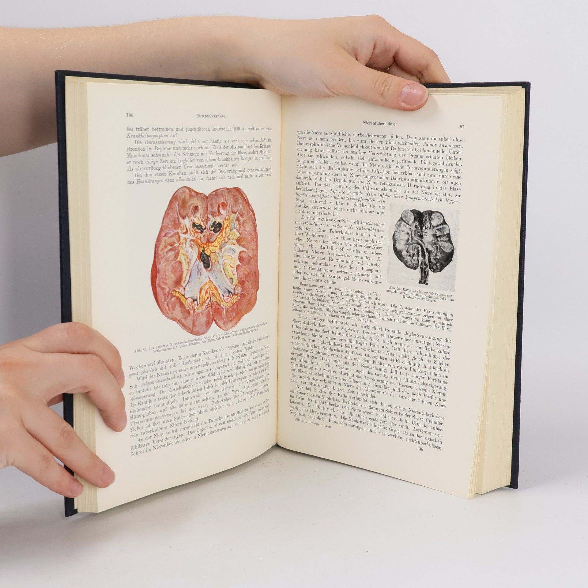Hans Wildbolz Lehrbuch der Urologie