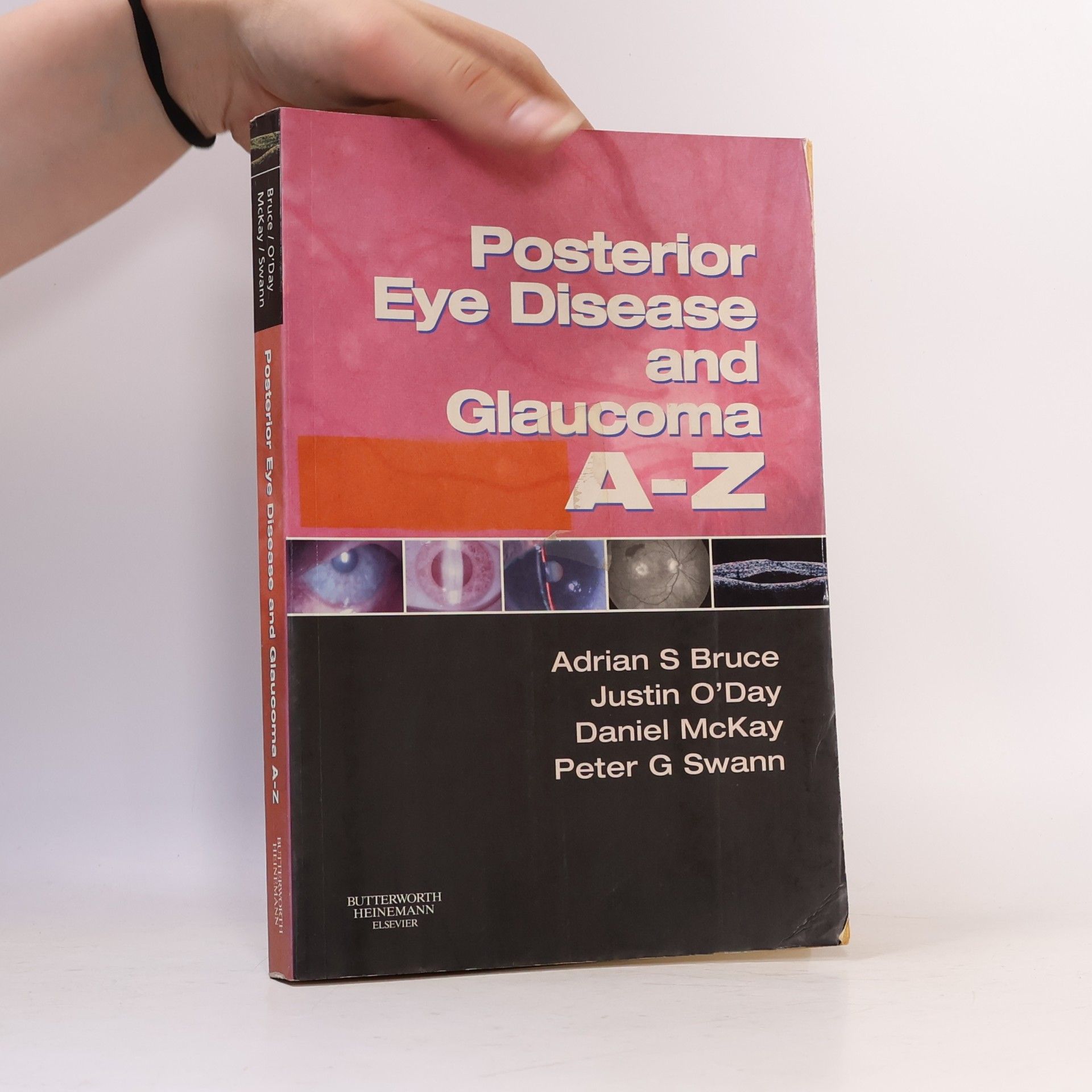 Peter G. Swann Posterior Eye Disease and Glaucoma A-Z