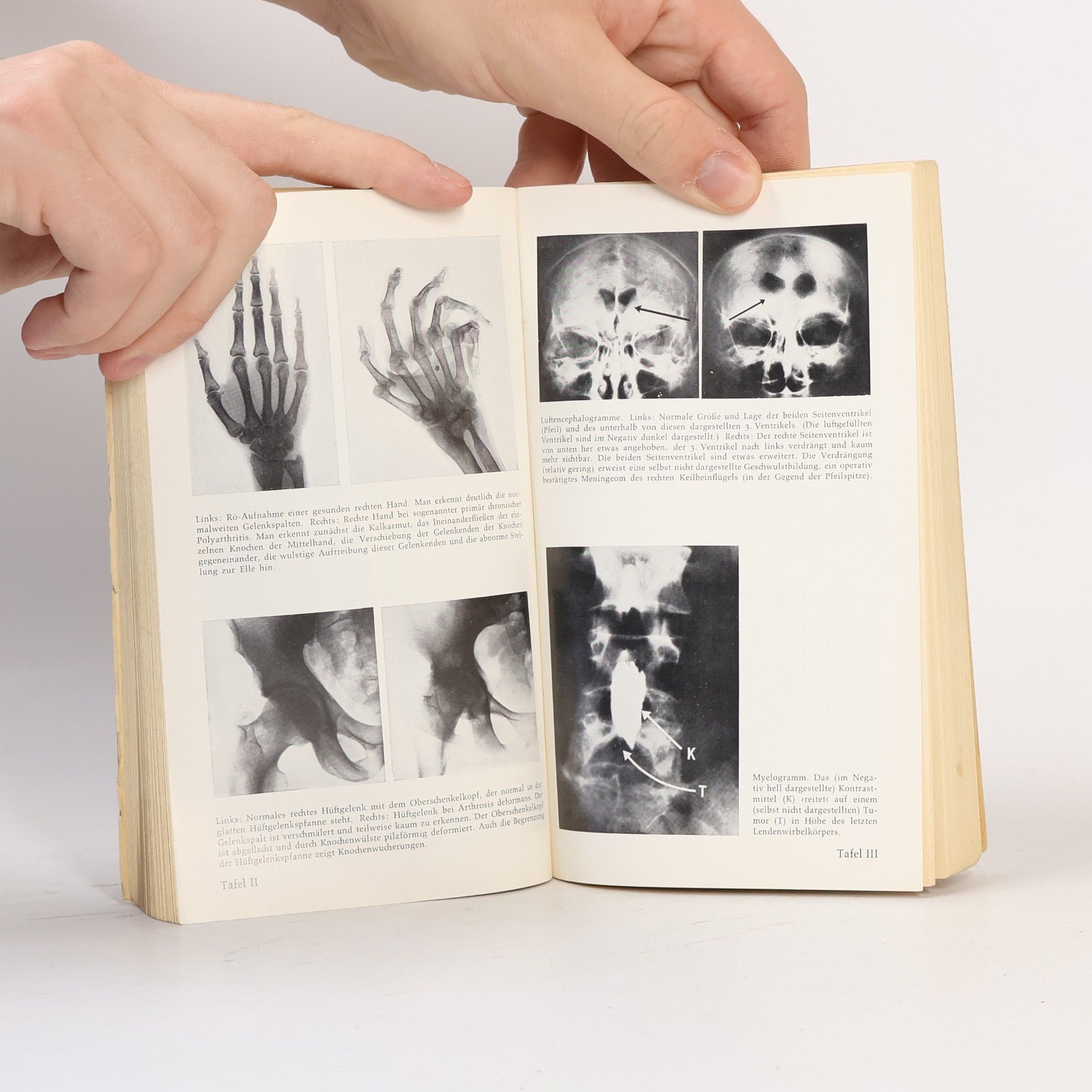 Collectif d'auteurs Das Fischer Lexikon. Medizin 3