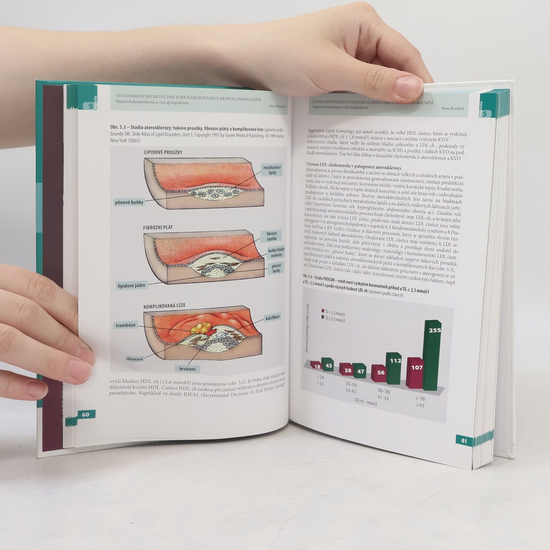 Hana Rosolová Preventivní kardiologie