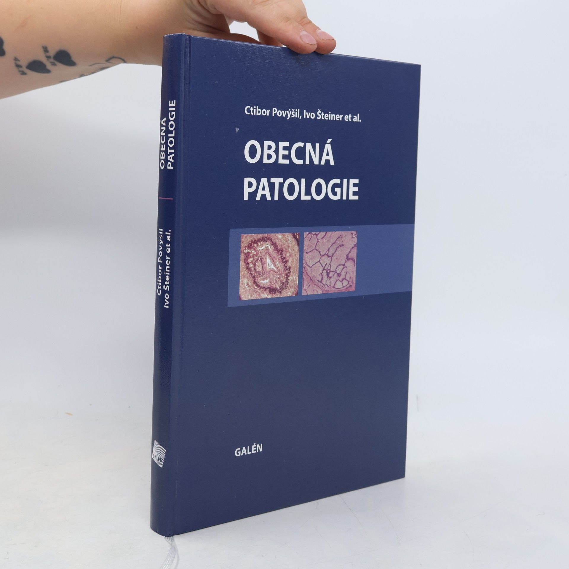 Ctibor Povýšil Obecná patologie