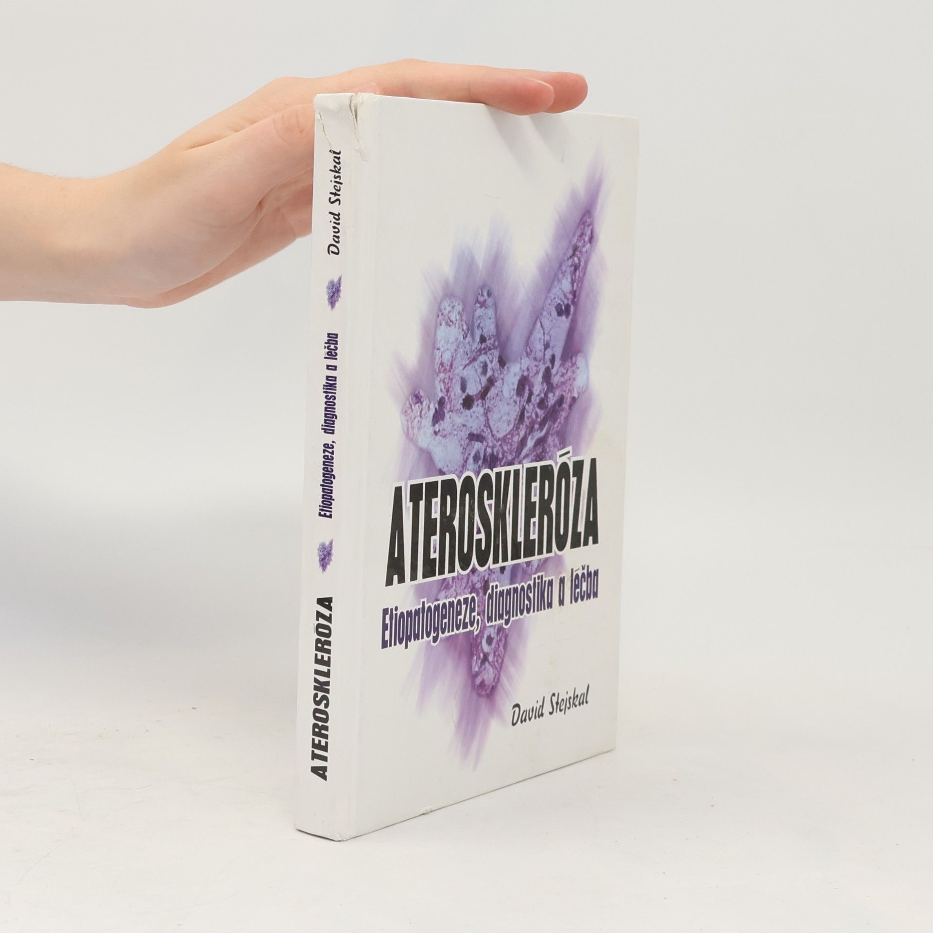 David Stejskal Ateroskleróza: Etiopatogeneze, diagnostika a léčba