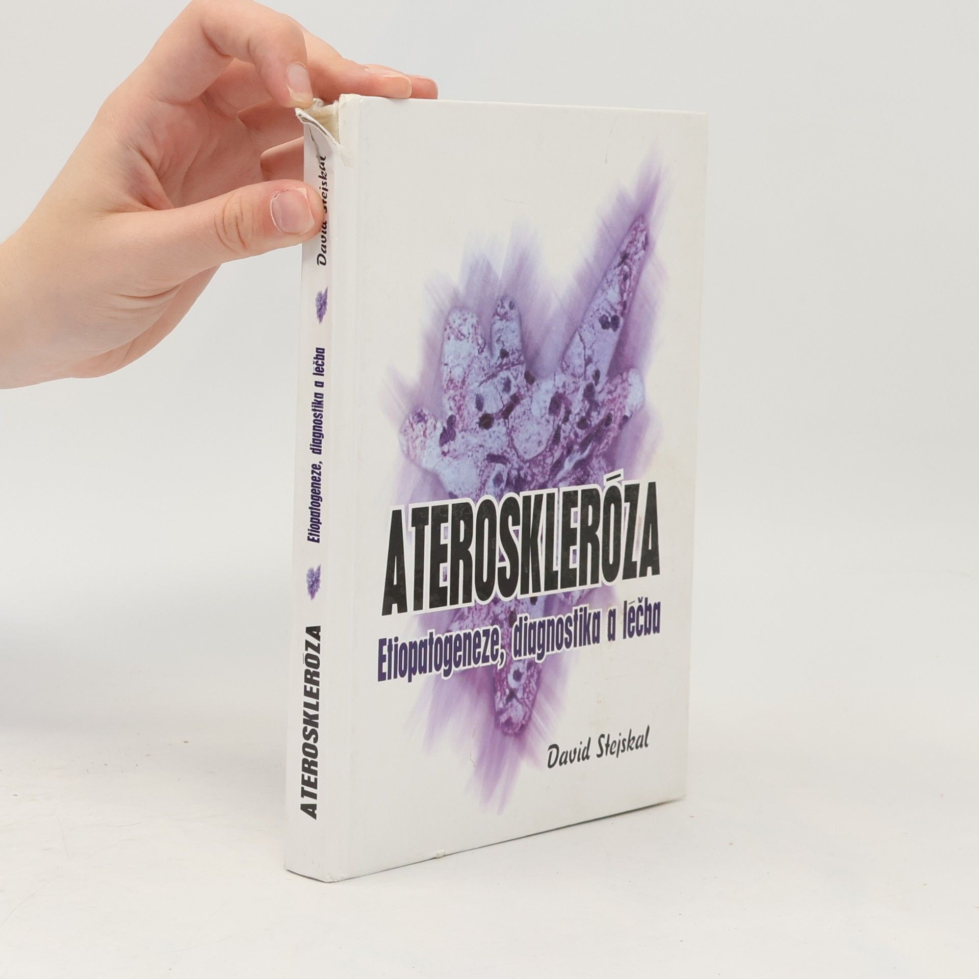 David Stejskal Ateroskleróza: Etiopatogeneze, diagnostika a léčba