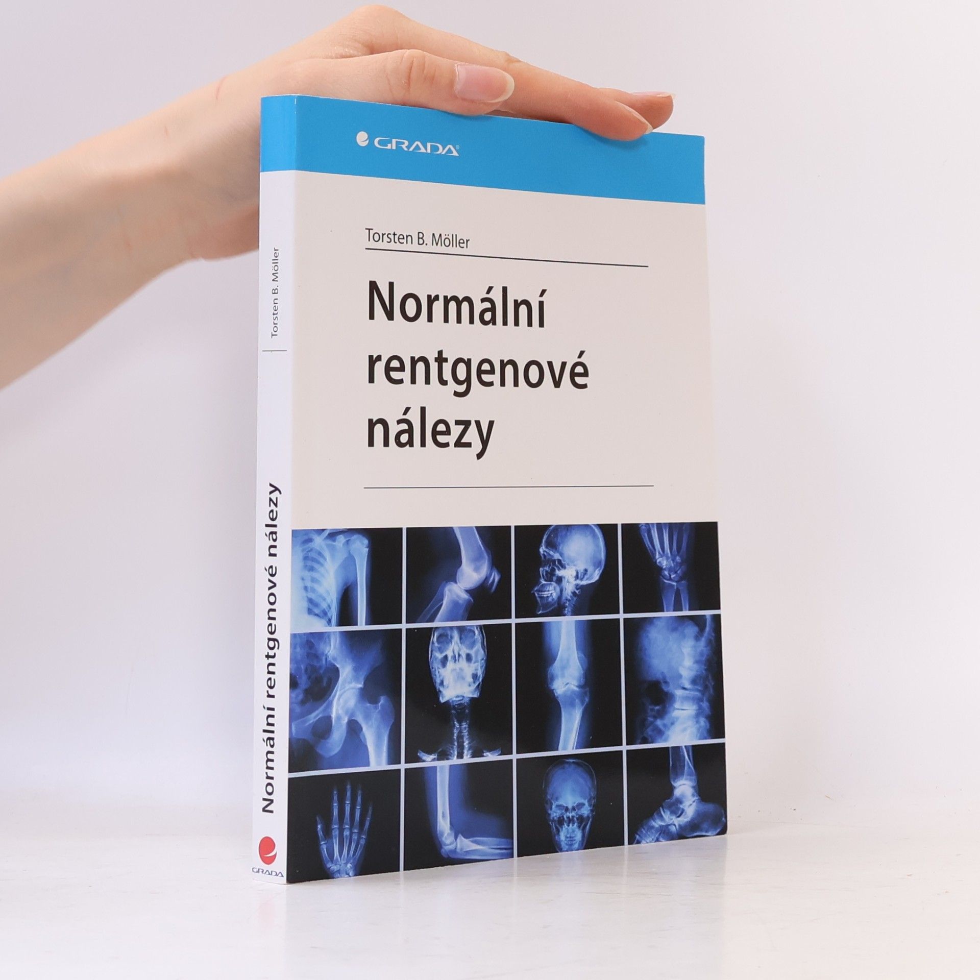 Normální rentgenové nálezy