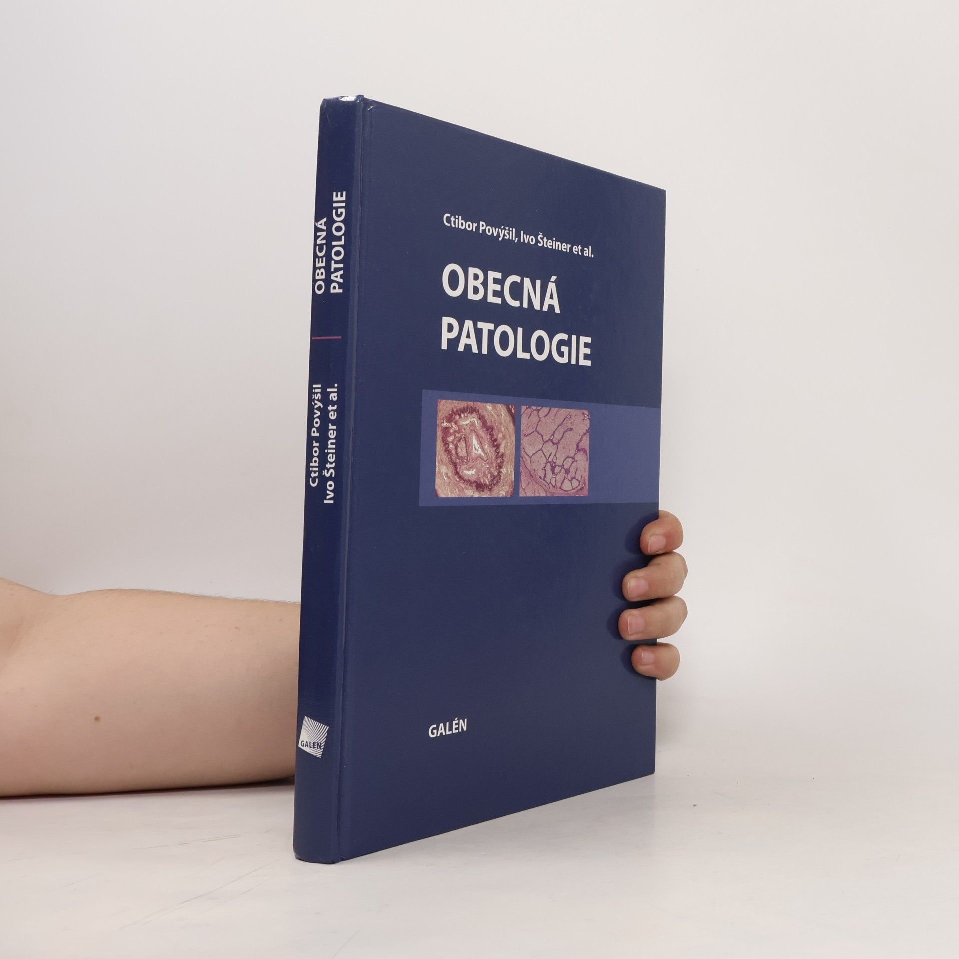 Ctibor Povýšil Obecná patologie