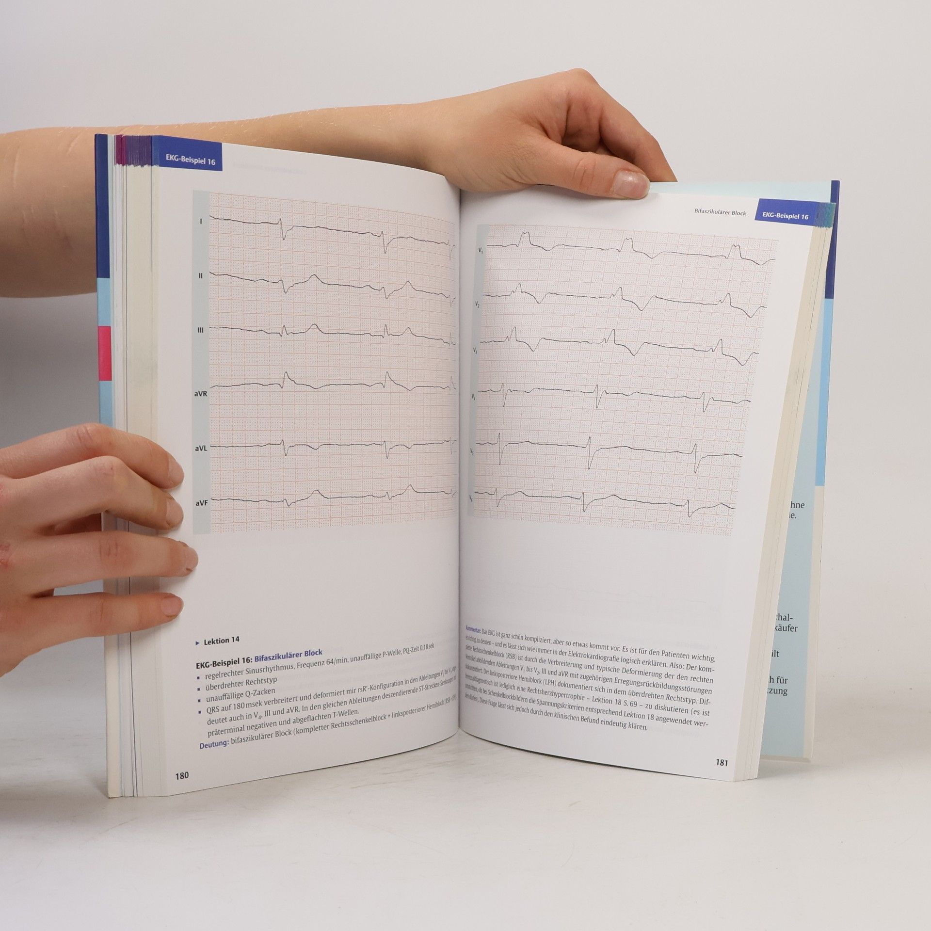 Hans Joachim Trappe EKG-Kurs für Isabel