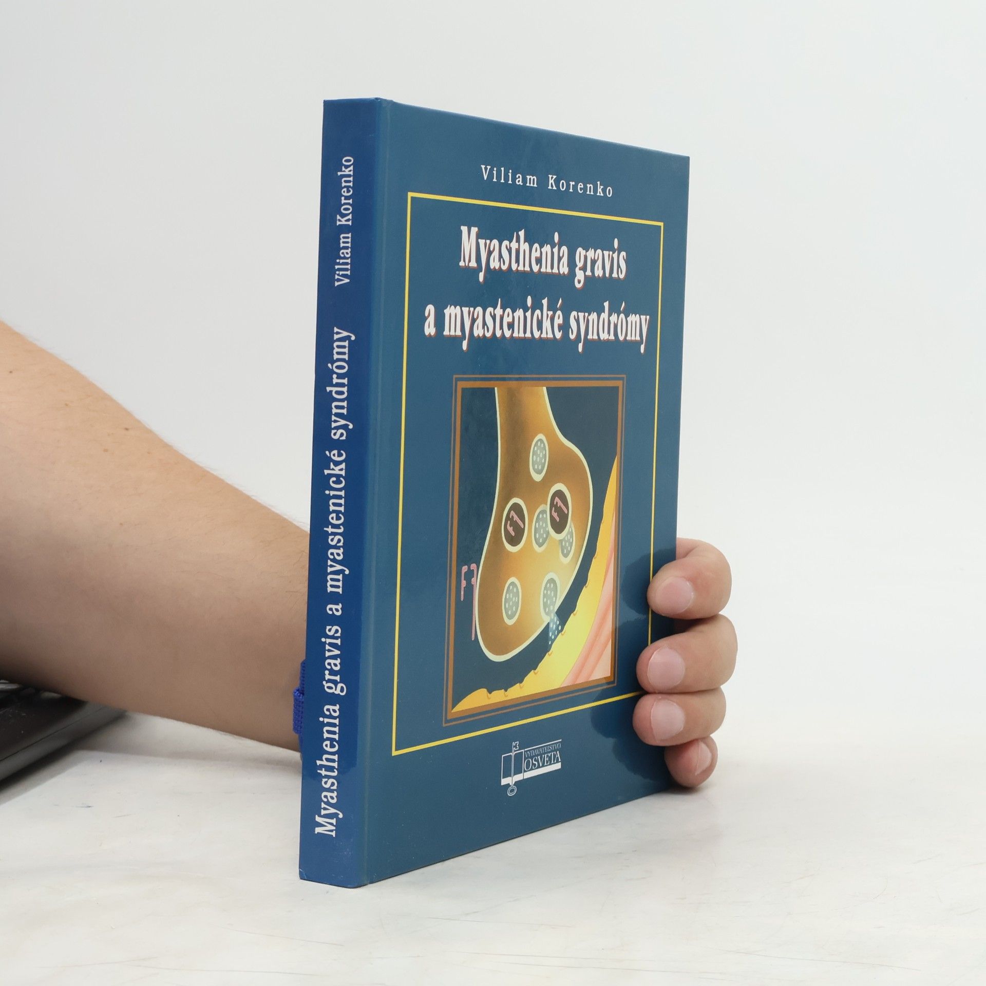 Viliam Korenko Myasthenia gravis a myastenické syndrómy