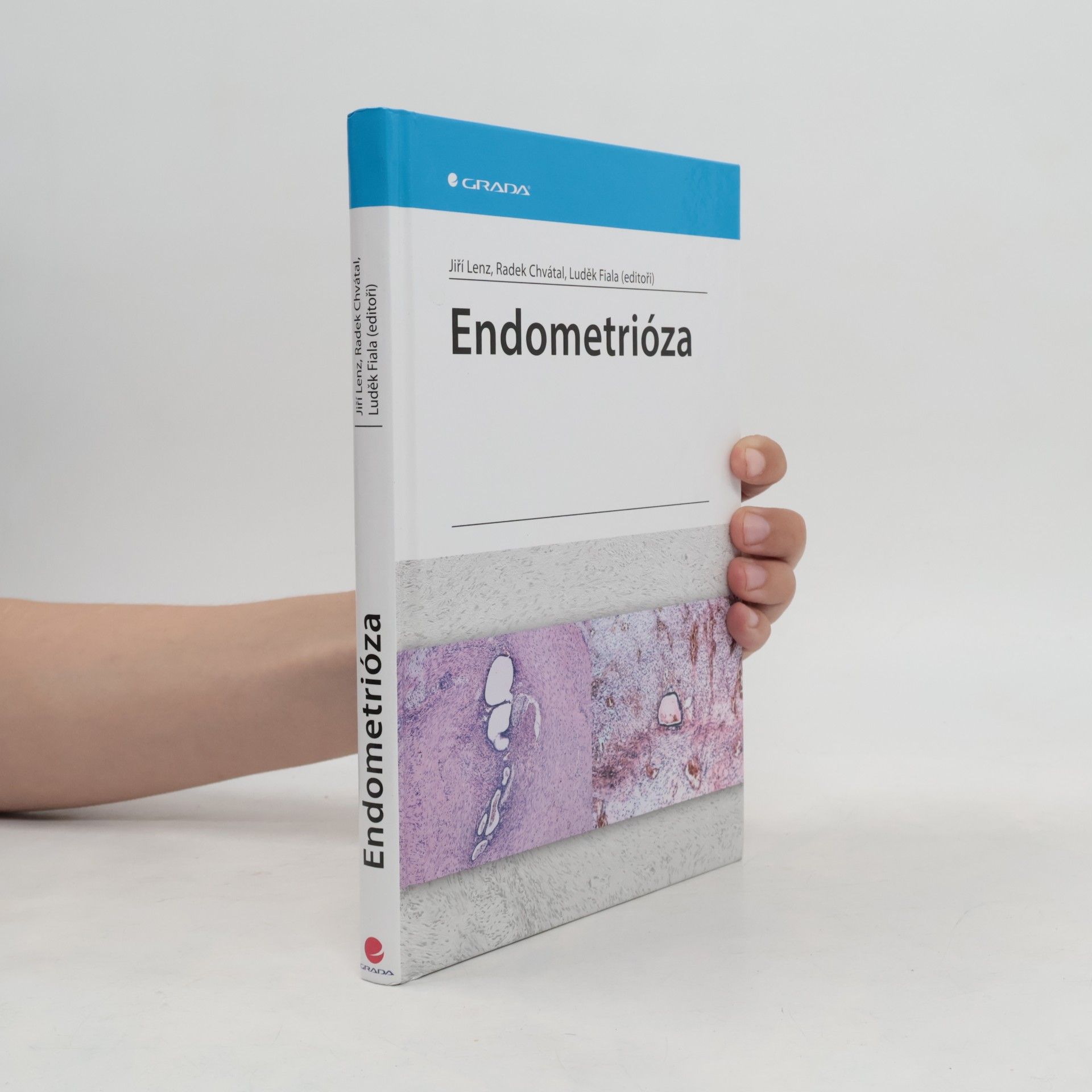 Radek Chvátal Endometrióza