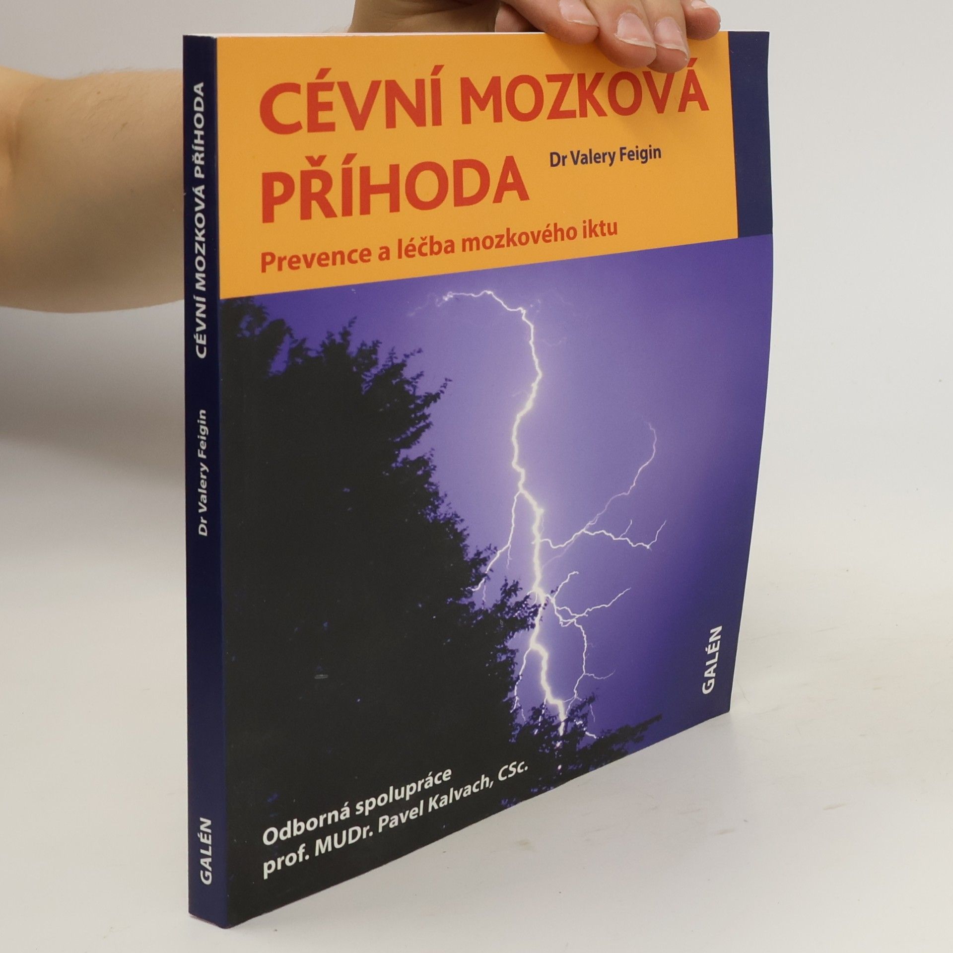Valery L. Feigin Cévní mozková příhoda - Prevence a léčba mozkového iktu