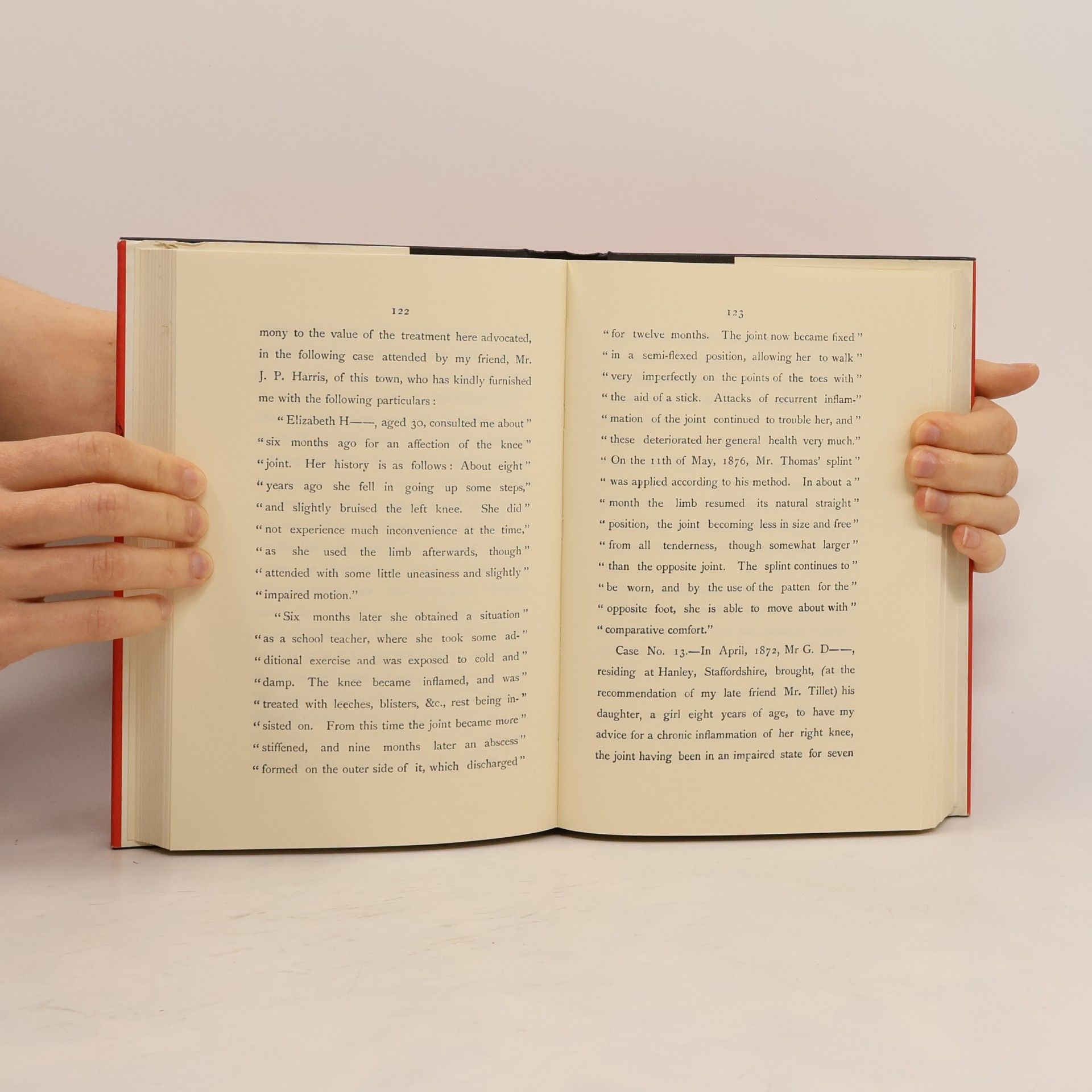 Hugh Owen Thomas Diseases of the Hip, Knee, and Ankle Joints