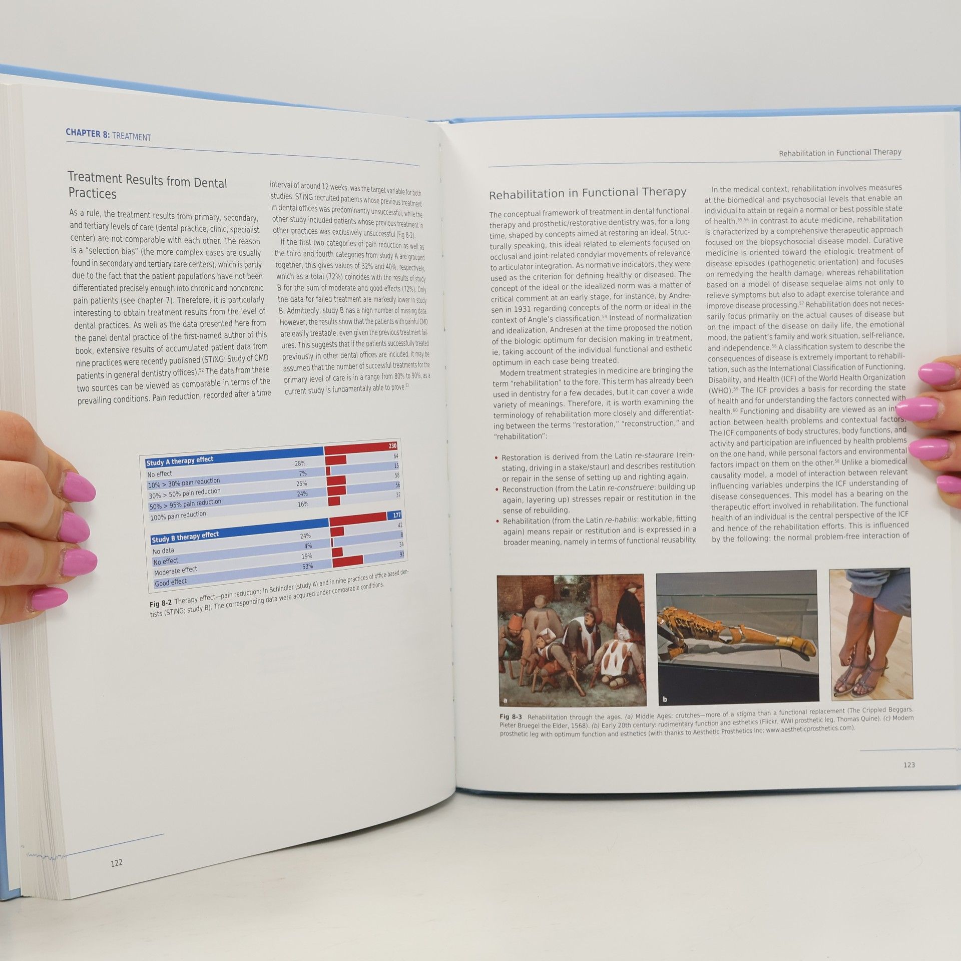 Hans Jürgen Schindler Occlusal Splints for Painful Craniomandibular Dysfunction