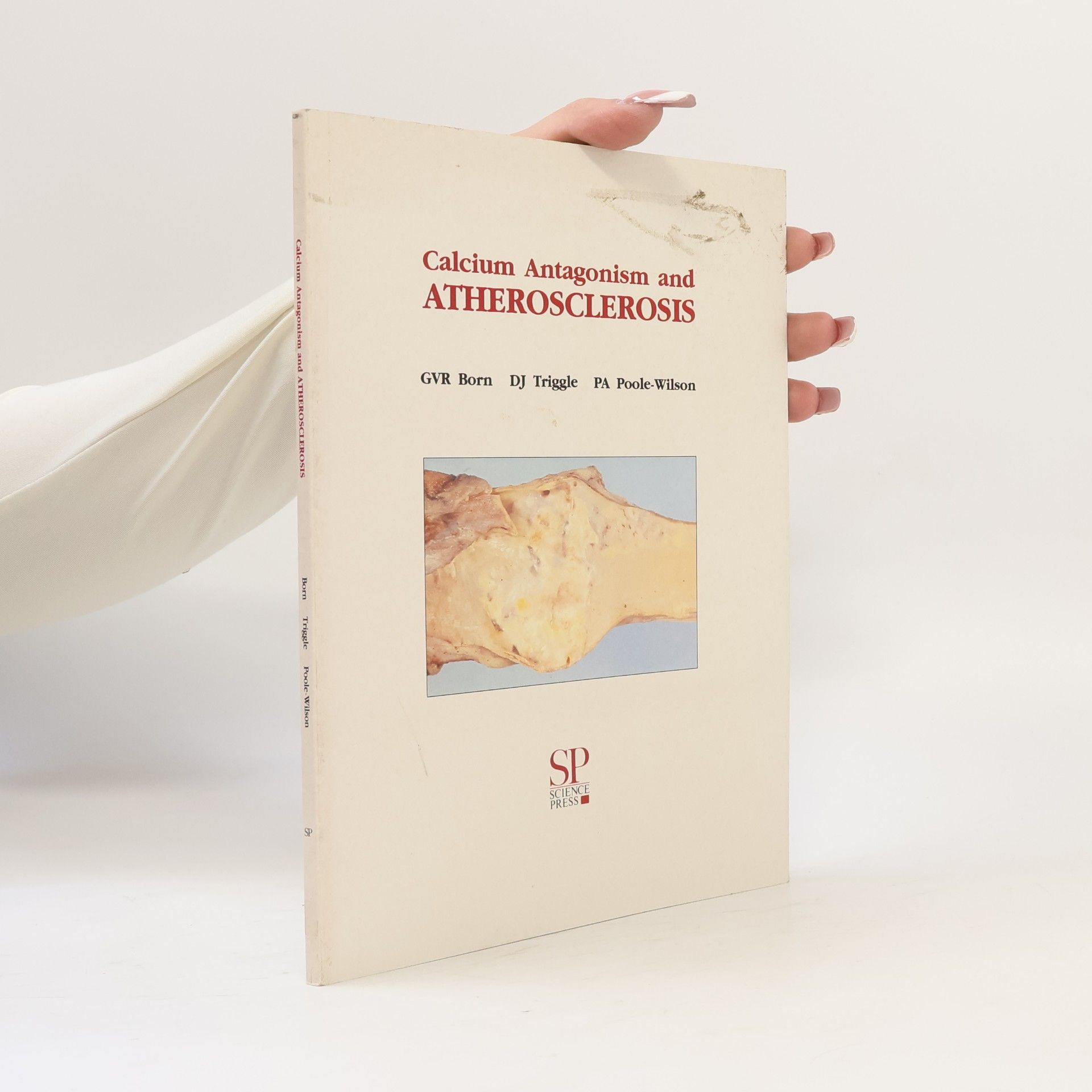 Philip Alexander Poole-Wilson Calcium Antagonism and Atherosclerosis
