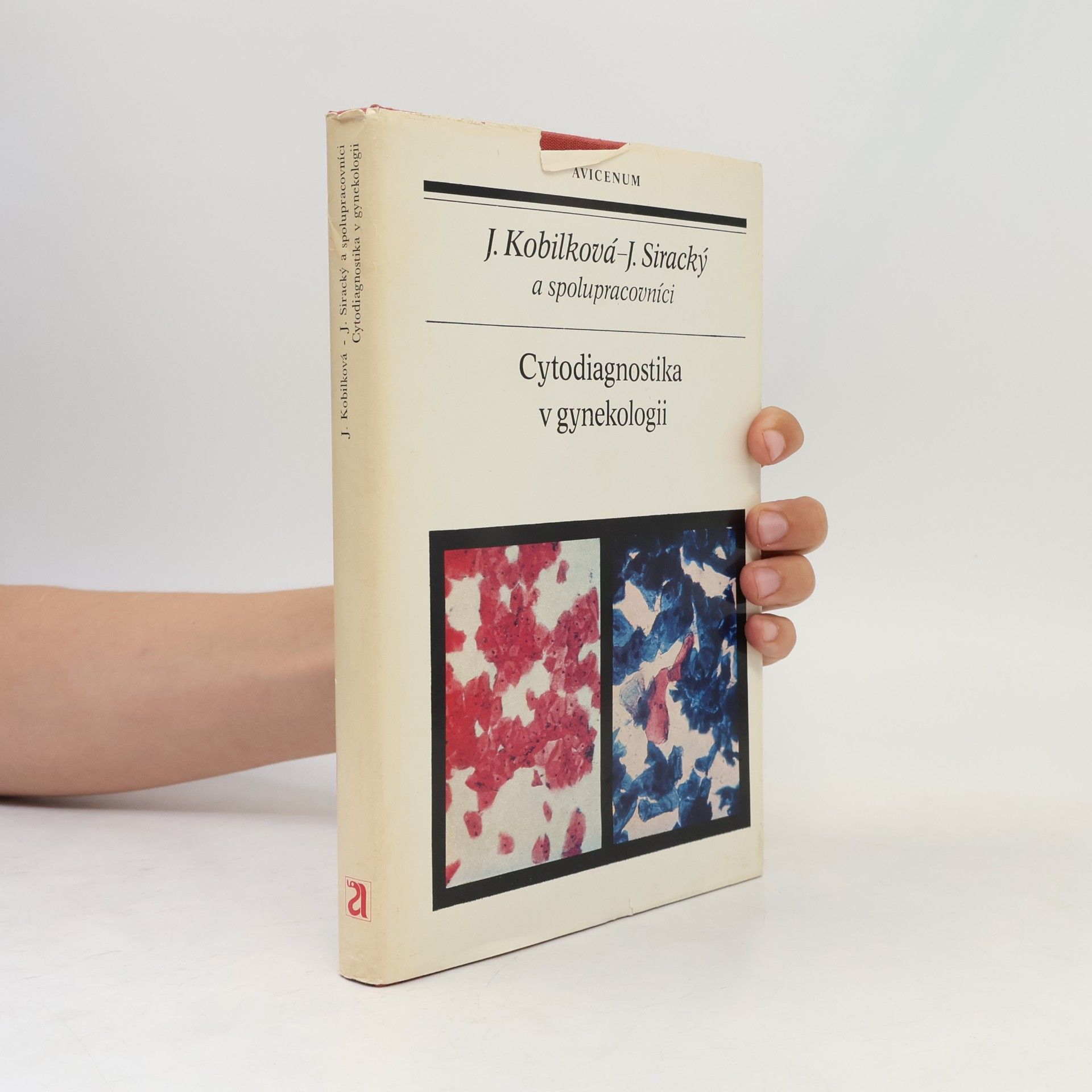 Jitka Kobilková Cytodiagnostika v gynekologii