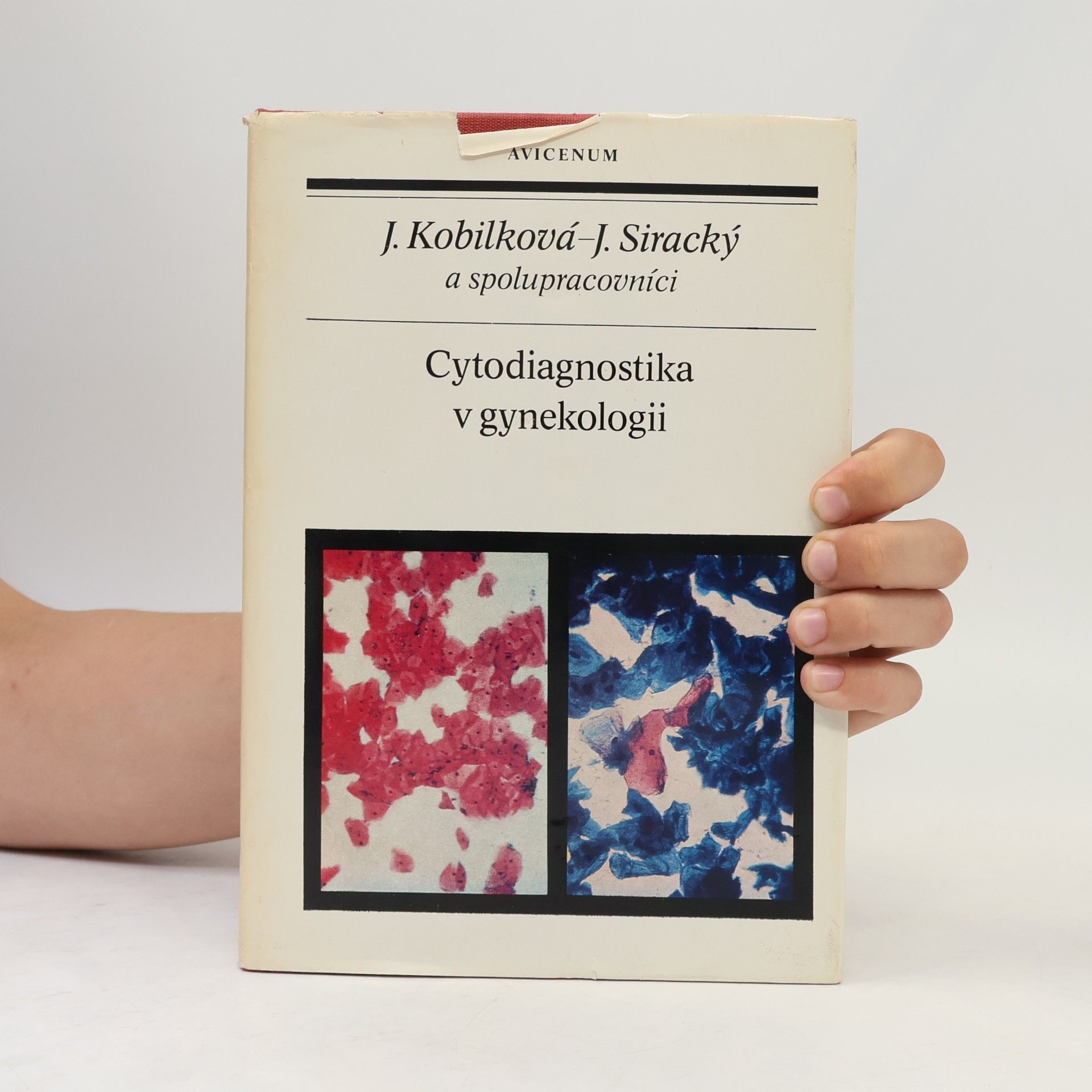 Jitka Kobilková Cytodiagnostika v gynekologii