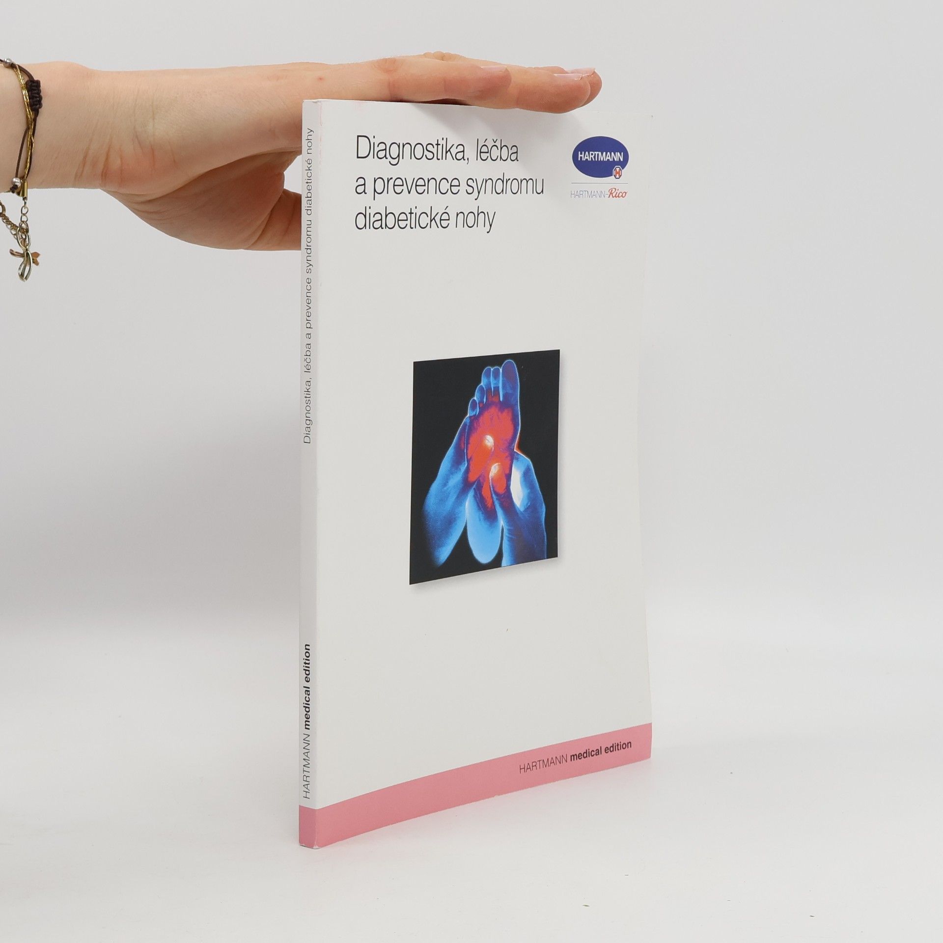 Diagnostika, léčba a prevence syndromu diabetické nohy
