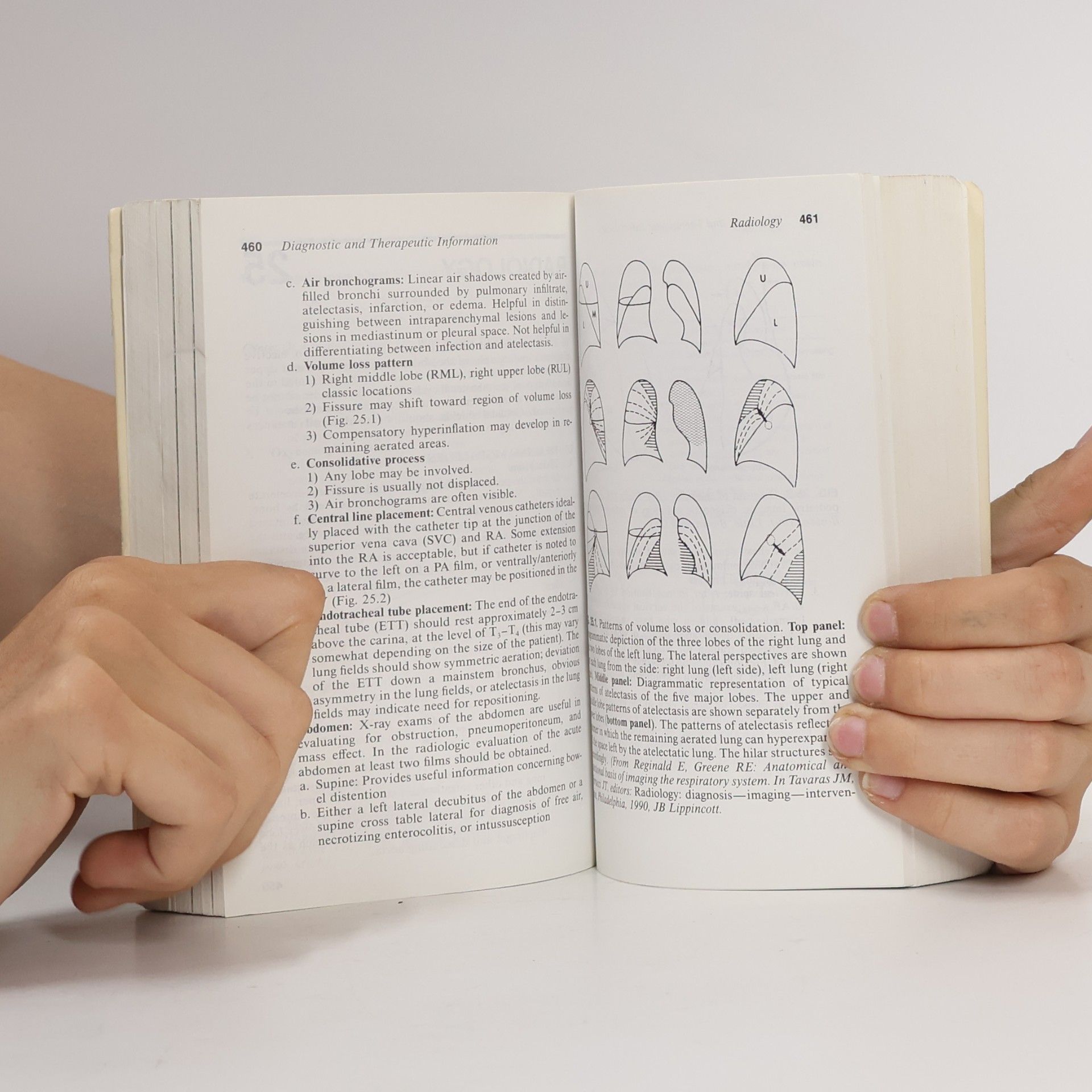 Michael A. Barone The Harriet Lane Handbook