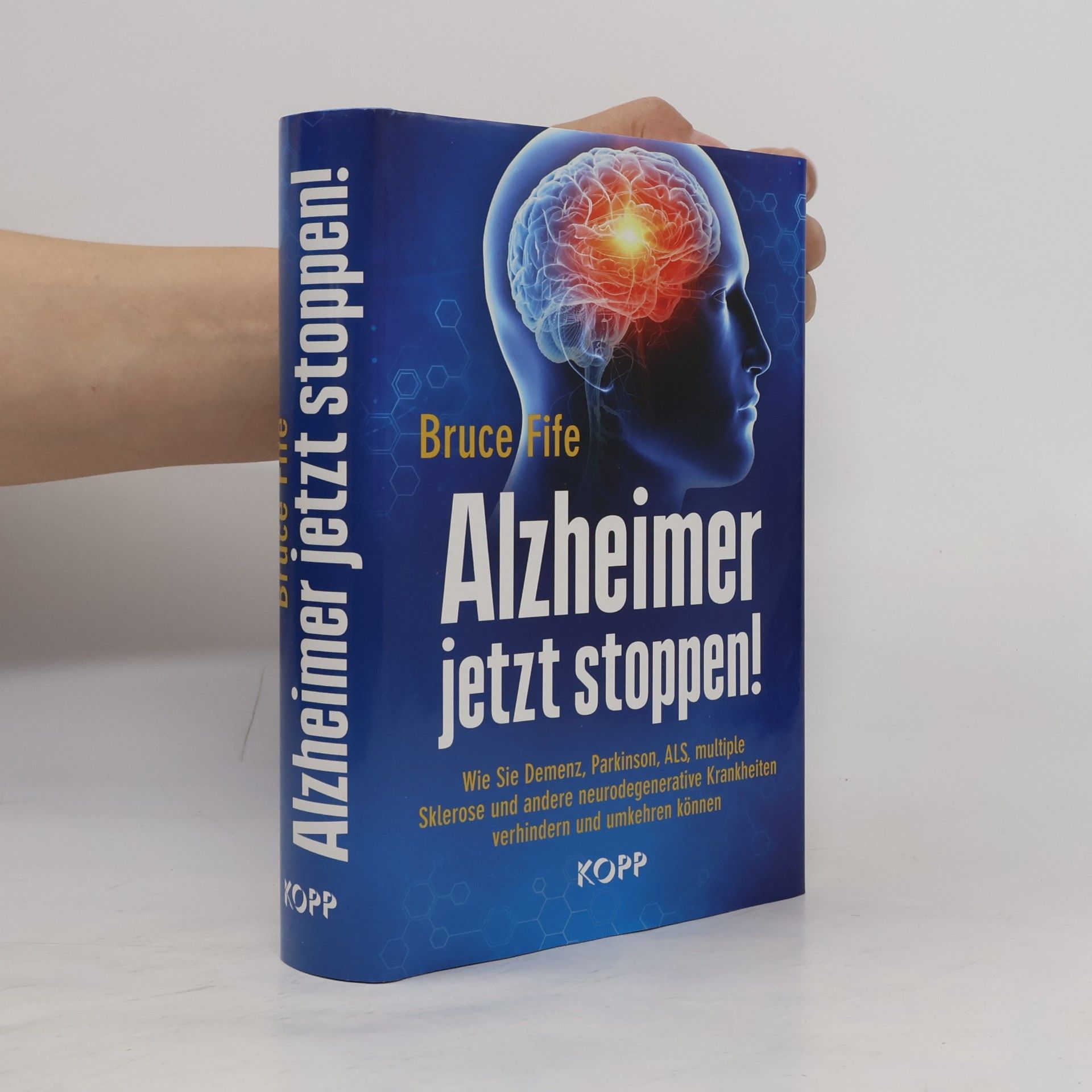 Alzheimer jetzt stoppen!