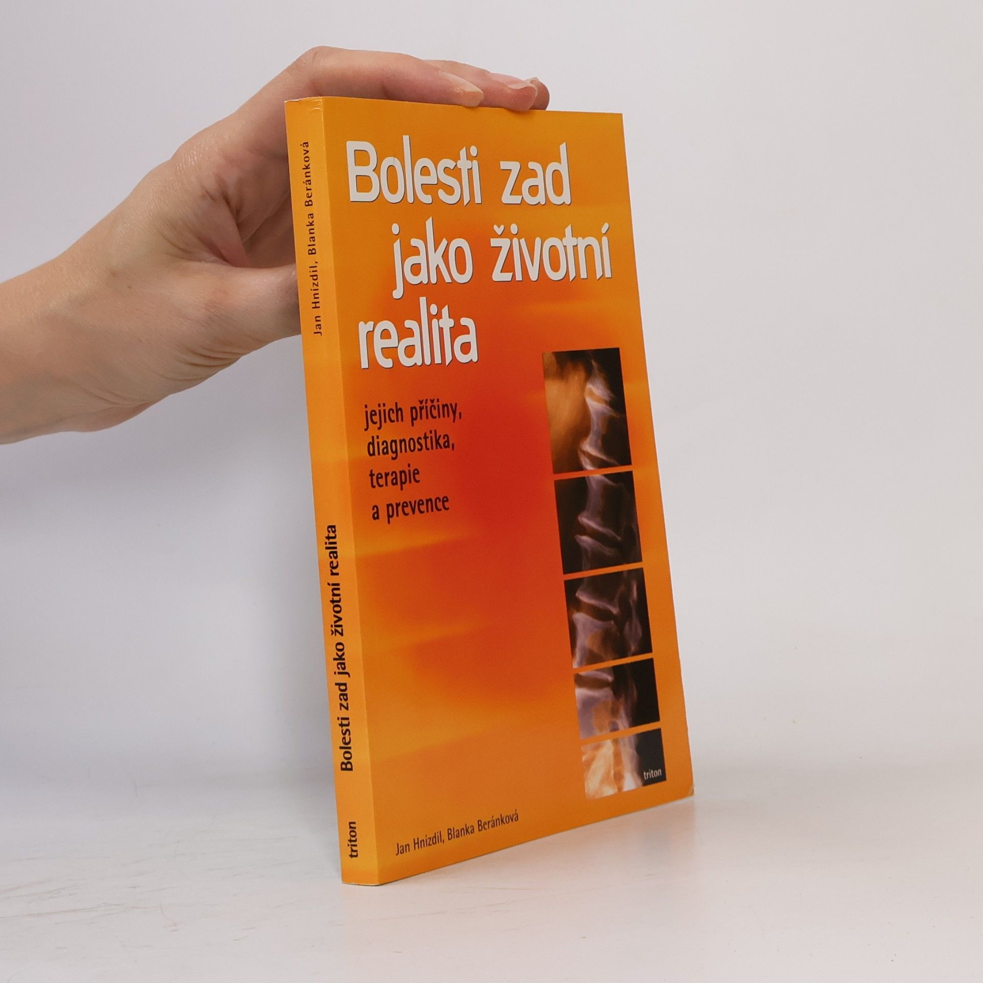 Jan Hnízdil Bolesti zad jako životní realita. Jejich příčiny, diagnostika, terapie a prevence