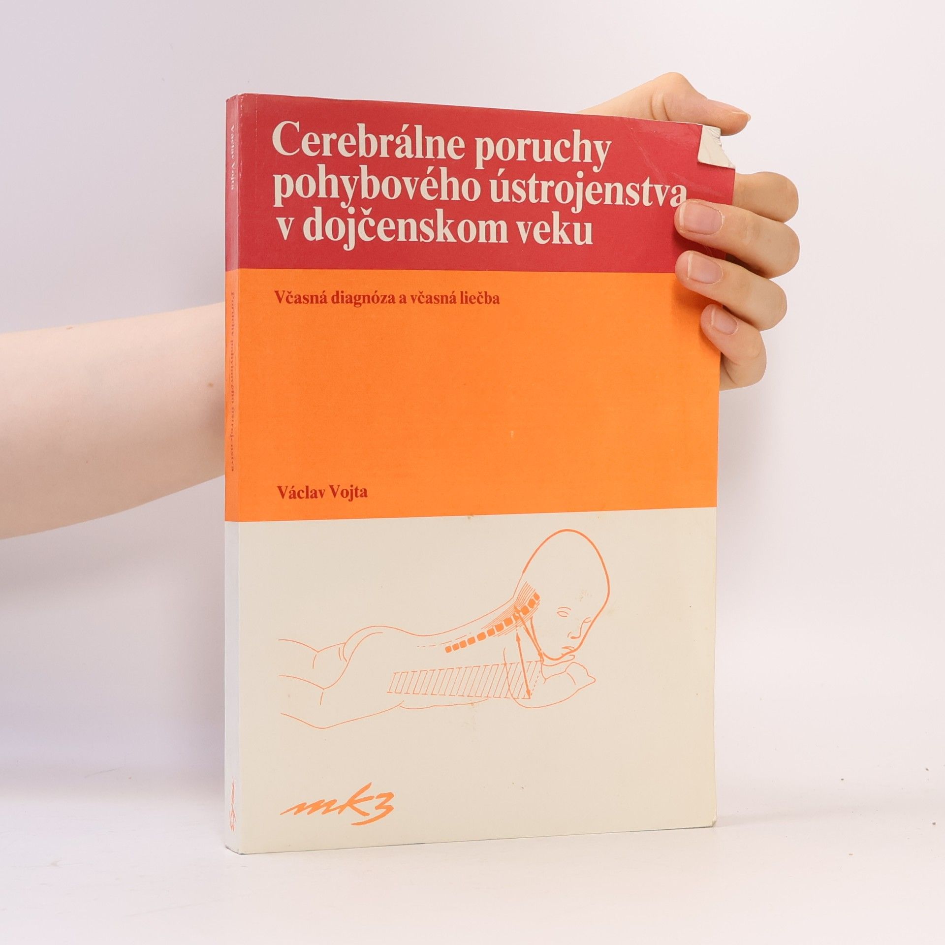 Václav Vojta Cerebrálne poruchy pohybového ústrojenstva v dojčenskom veku