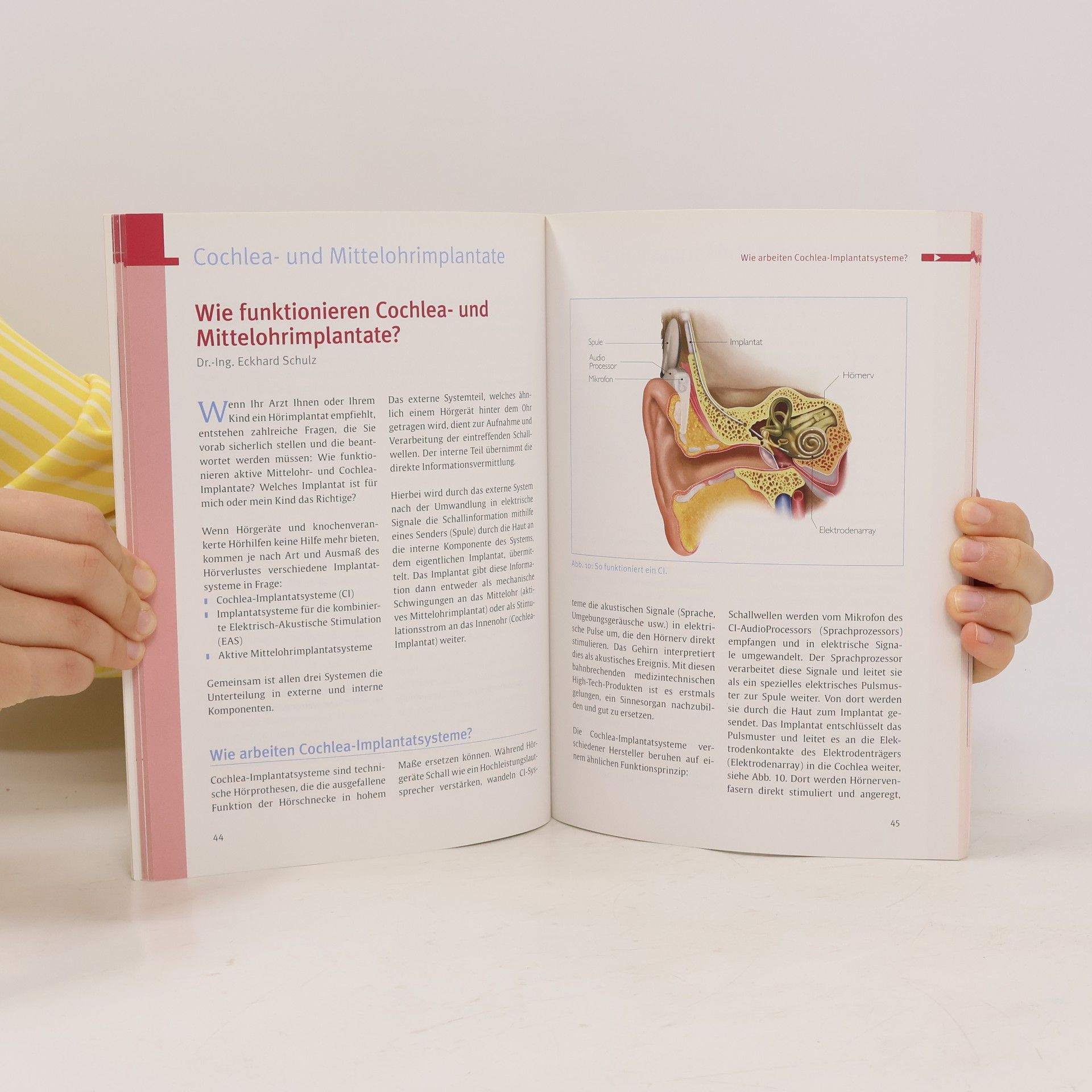 Marion Hermann-Röttgen Cochlea-Implantat