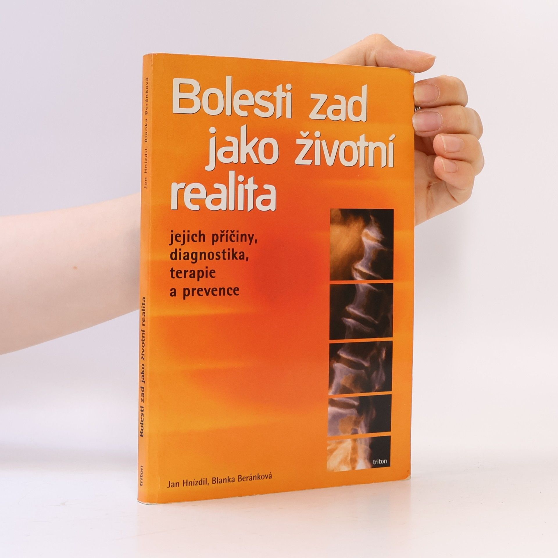 Bolesti zad jako životní realita. Jejich příčiny, diagnostika, terapie a prevence