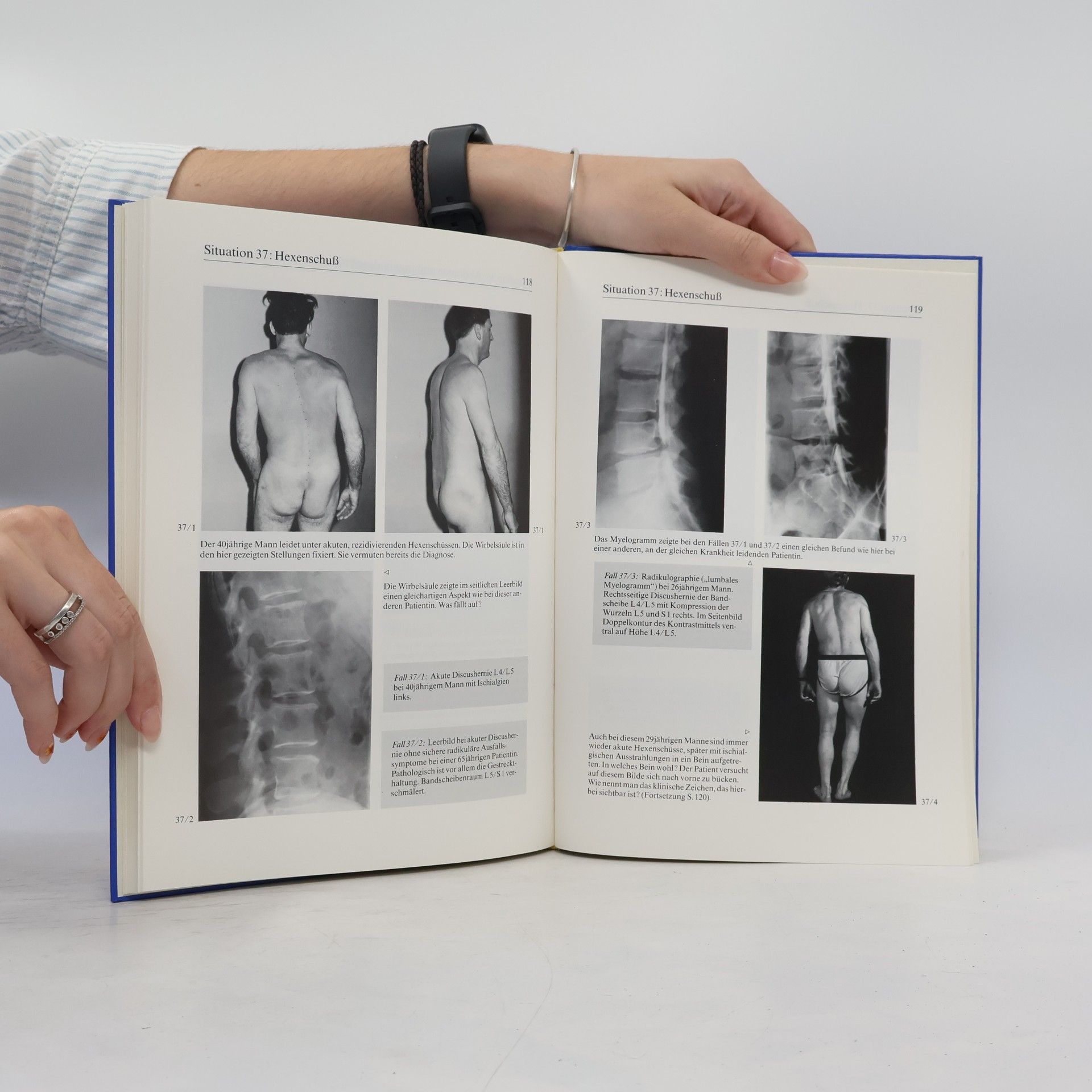 Marco Mumenthaler Didaktischer Atlas der klinischen Neurologie