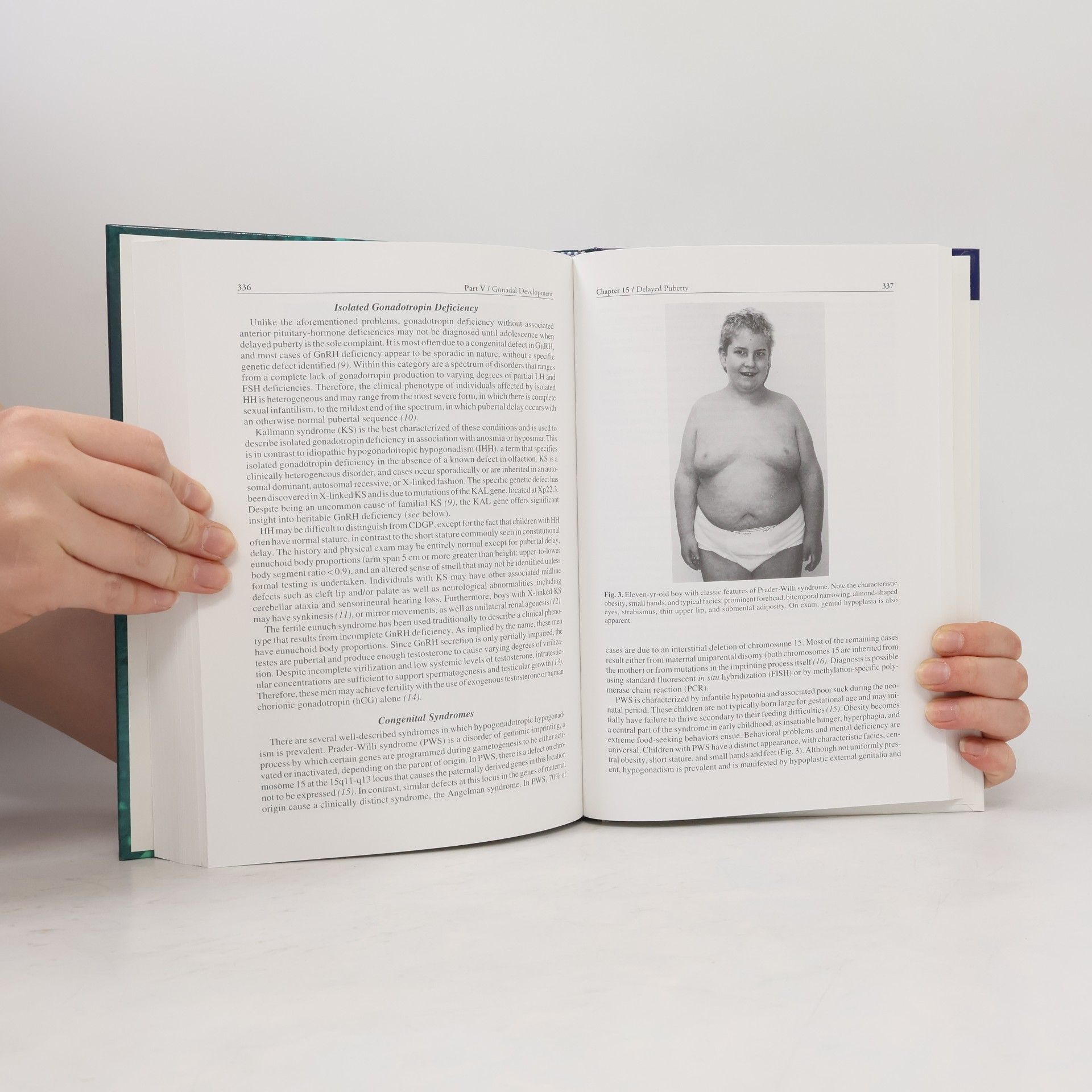 Erica A. Eugster Contemporary Endocrinology: Developmental Endocrinology