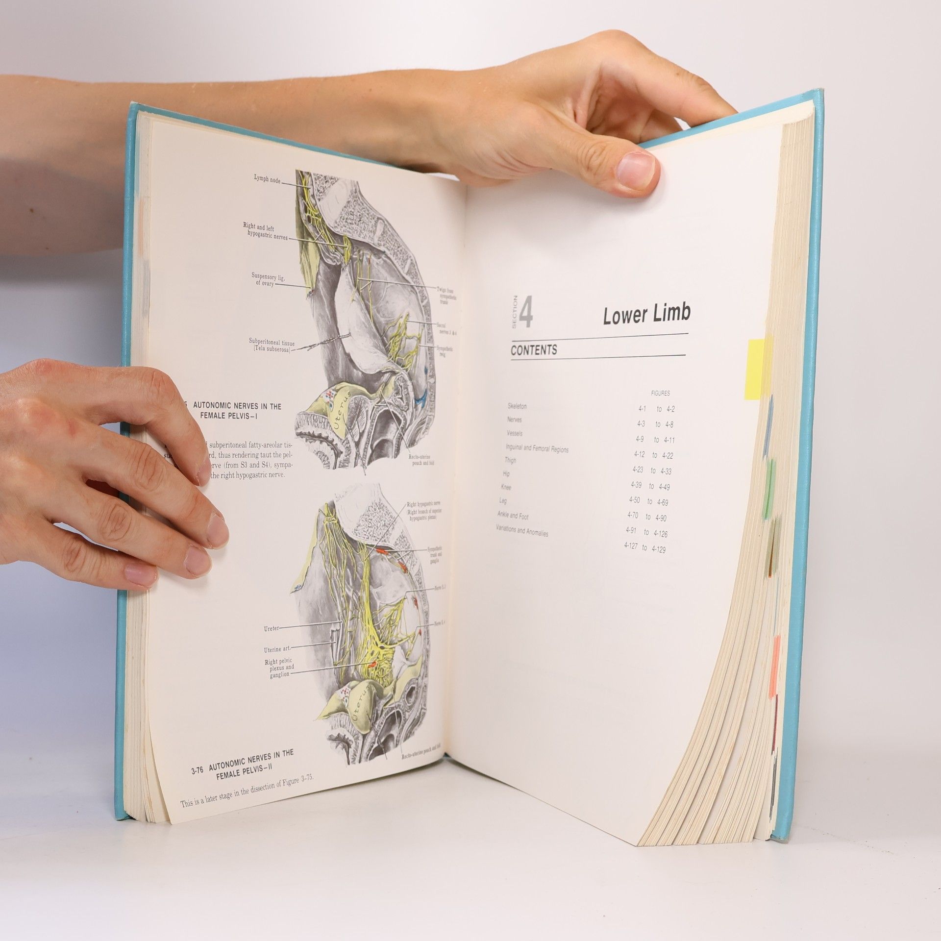 John Charles Boileau Grant Grant's Atlas of anatomy.