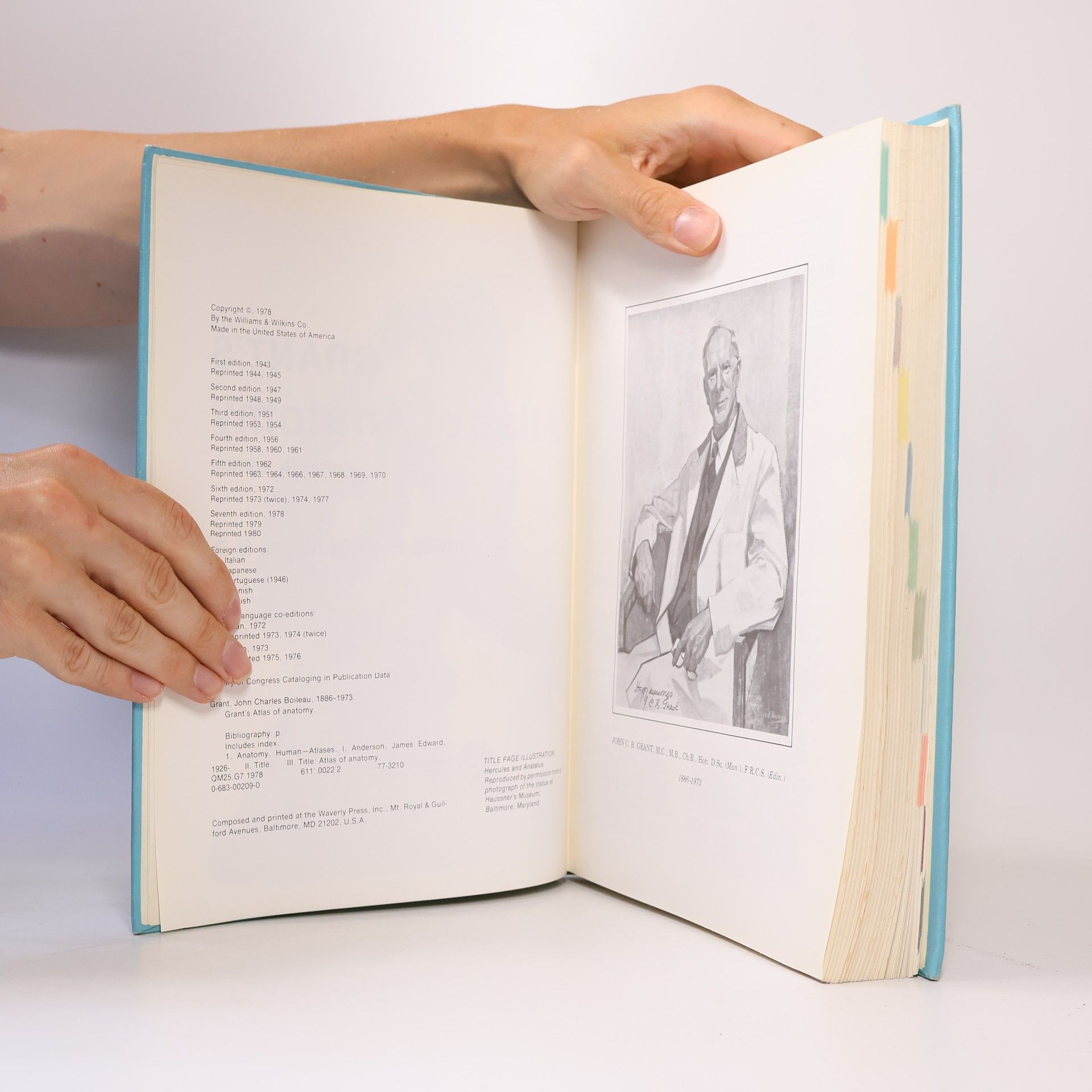 John Charles Boileau Grant Grant's Atlas of anatomy.