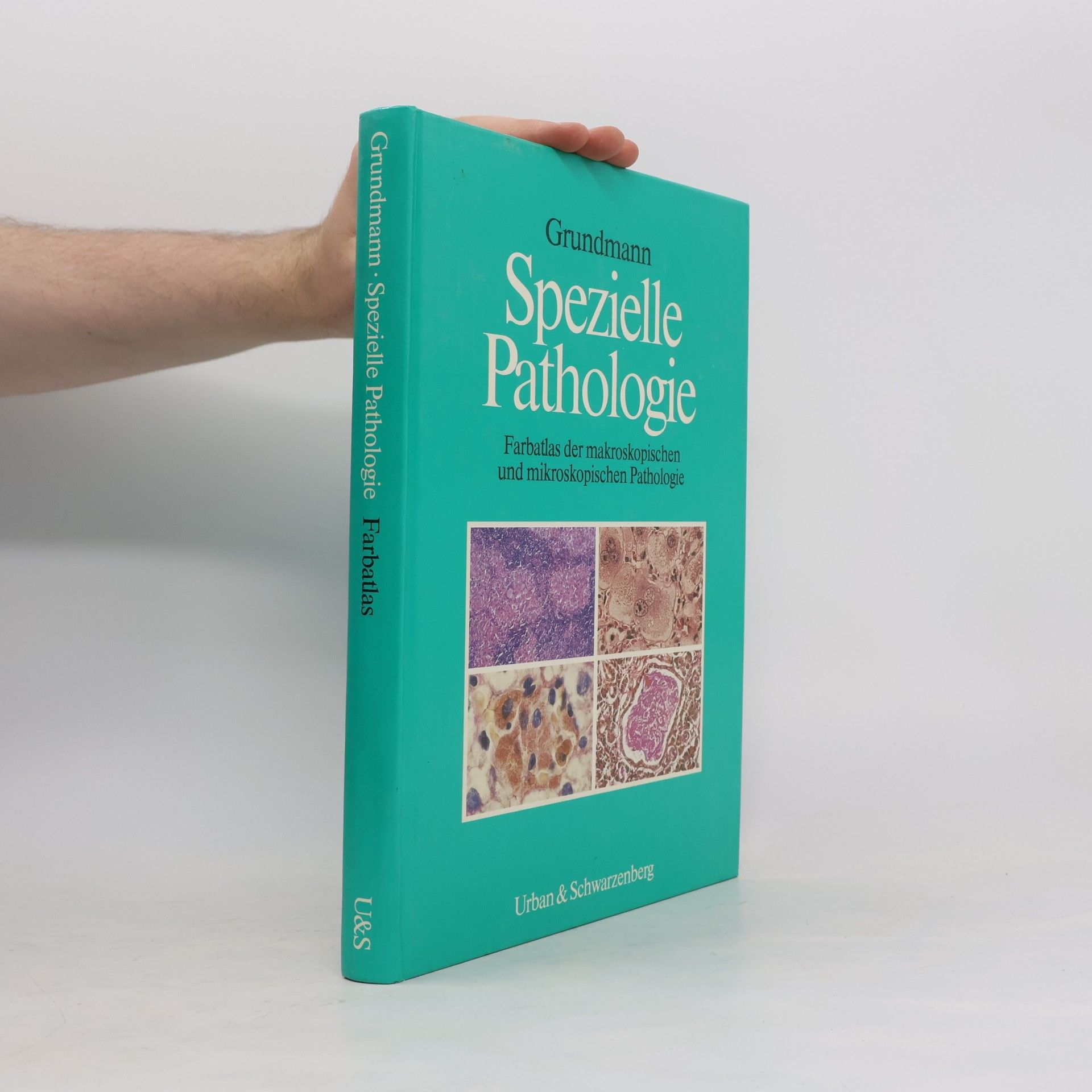 Ekkehard Grundmann Spezielle Pathologie